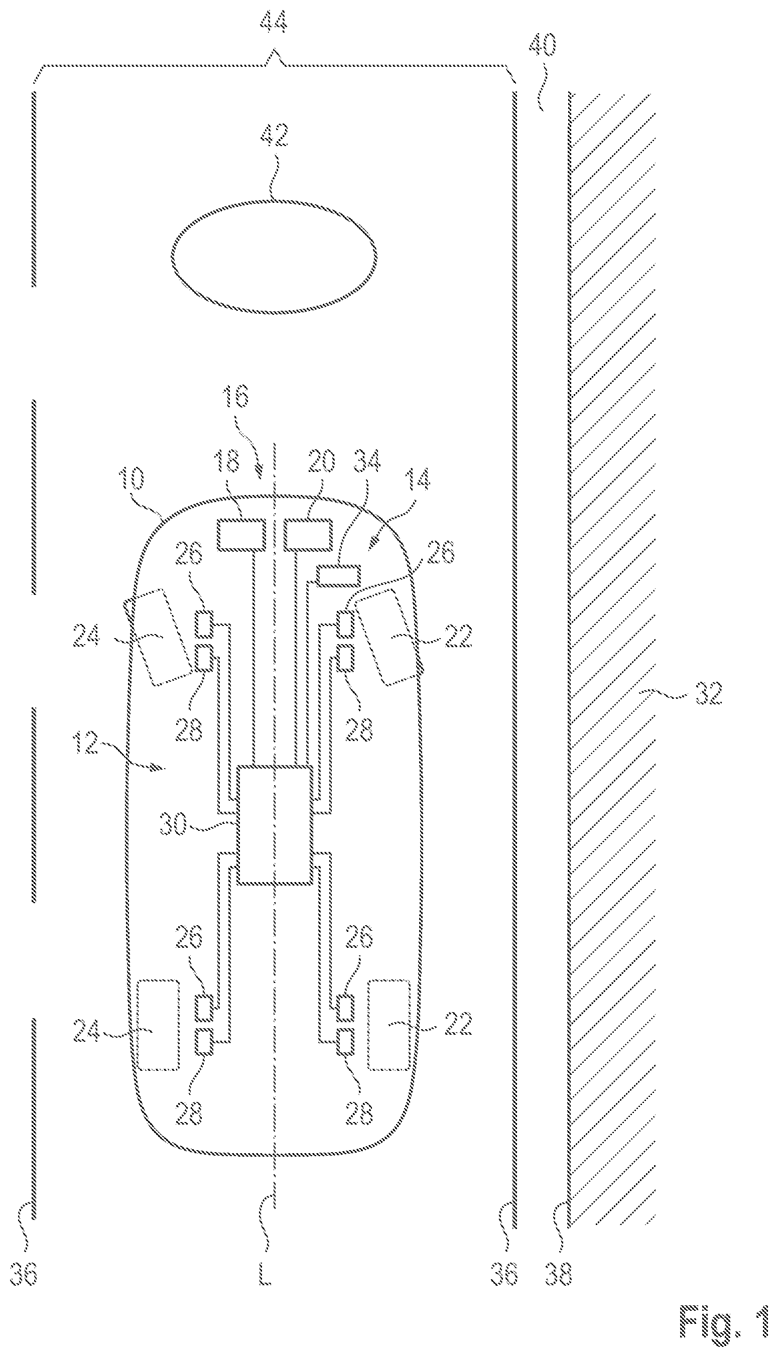 Patent US12097885 — Assistance system and method for avoiding false activations of a shoulder function — Figure 1
