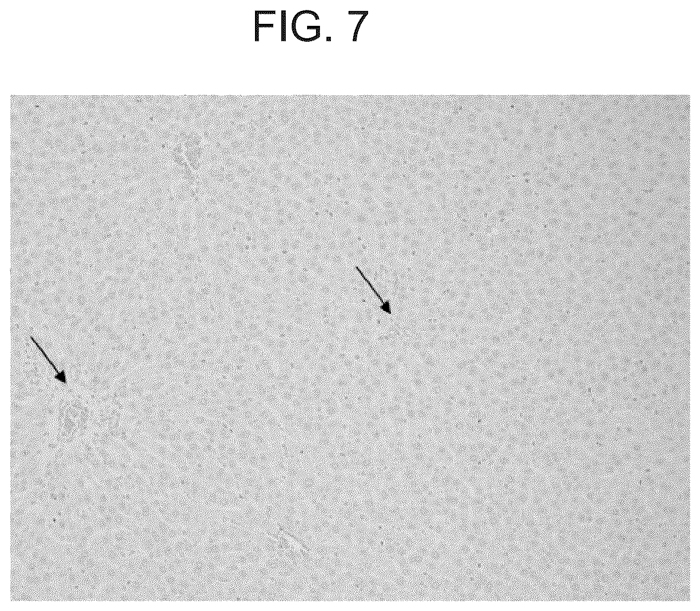 Patent US12098192 Figure 7 – Composition and method for the diagnosis and treatment of iron-related disorders