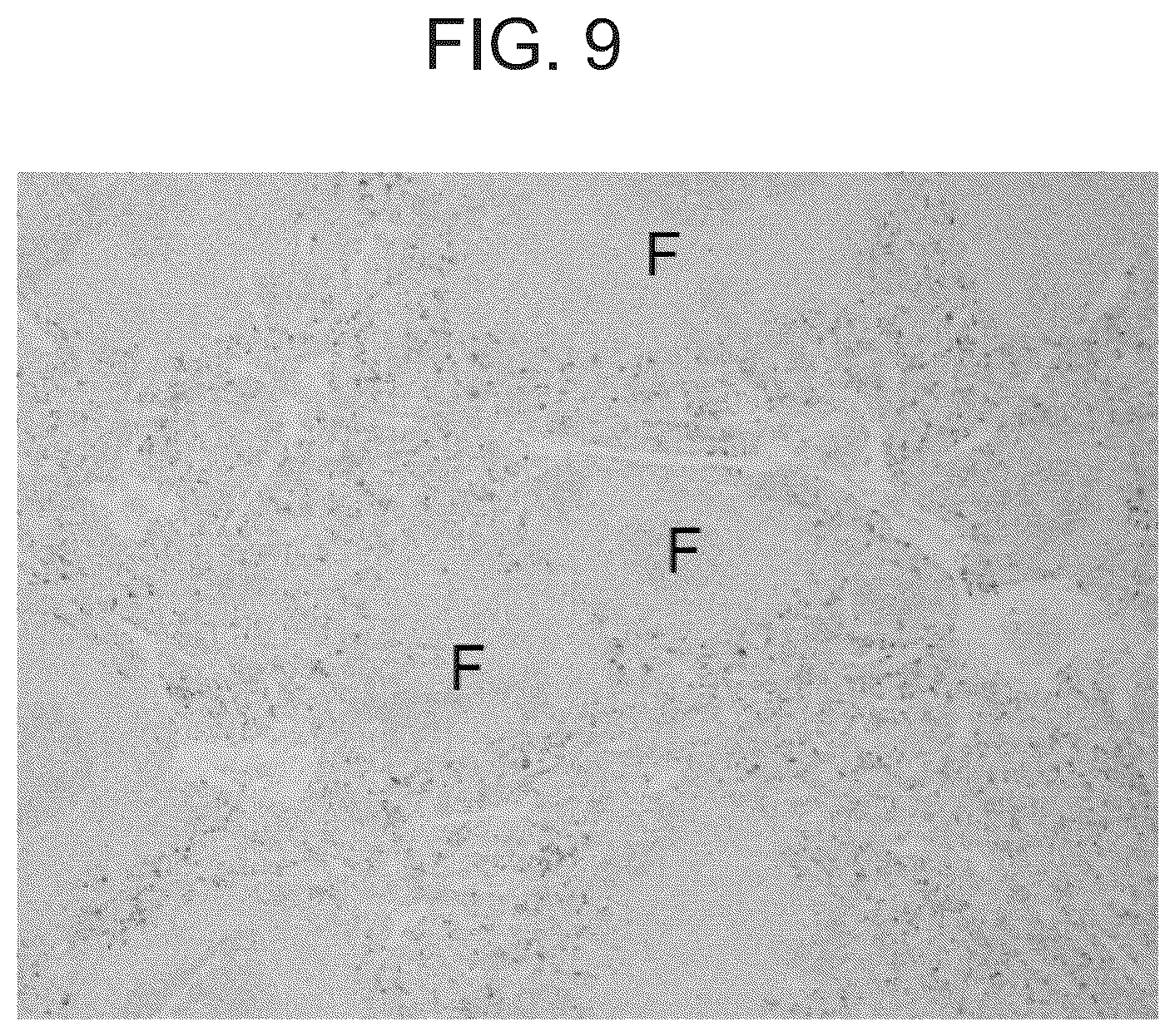 Patent US12098192 Figure 9 – Composition and method for the diagnosis and treatment of iron-related disorders