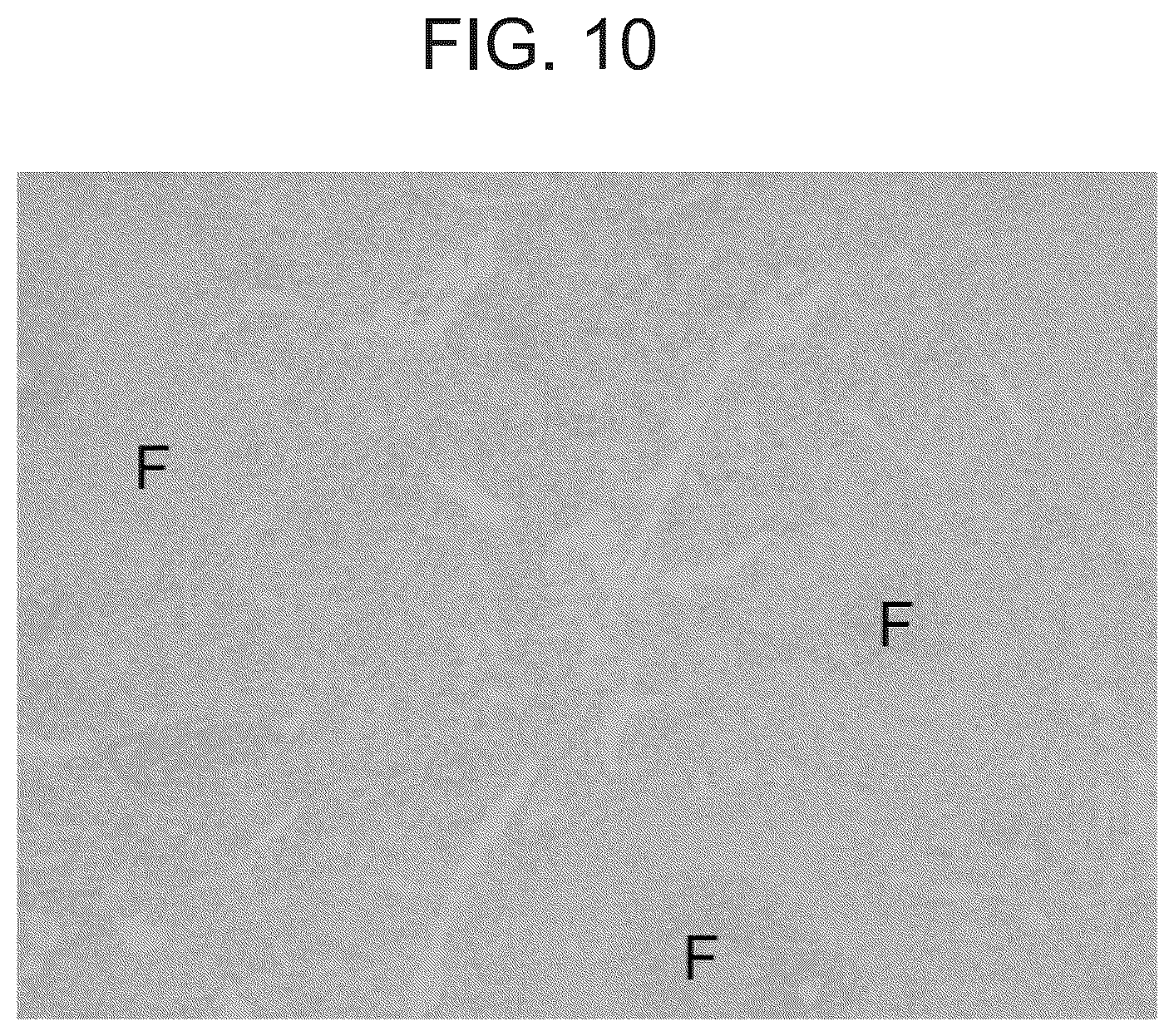 Patent US12098192 Figure 10 – Composition and method for the diagnosis and treatment of iron-related disorders
