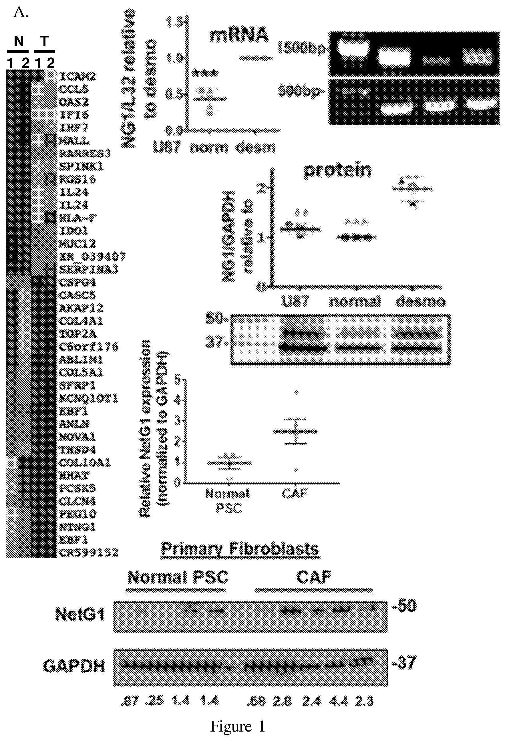 Patent US12098193 — Netrin G1 as a biomarker for enhancing tumor treatment efficacy — Figure 1