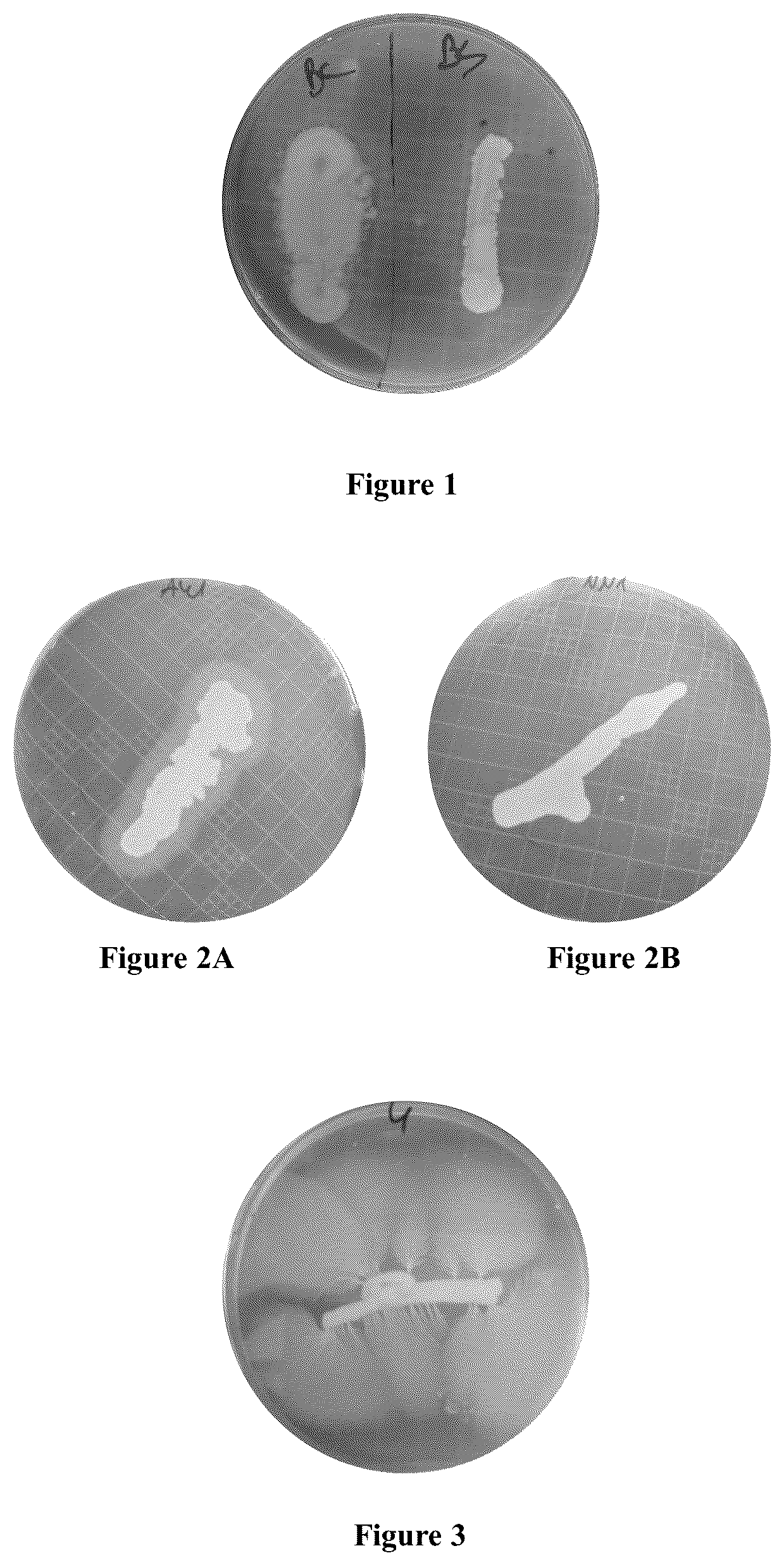 Patent US12098409 — Probiotic bacteria for yeast bioethanol production — Figure 1