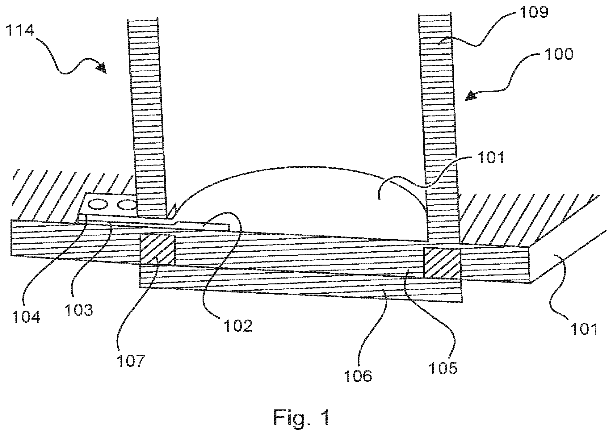 Patent US12099137 — Radar module comprising a microwave chip — Figure 1
