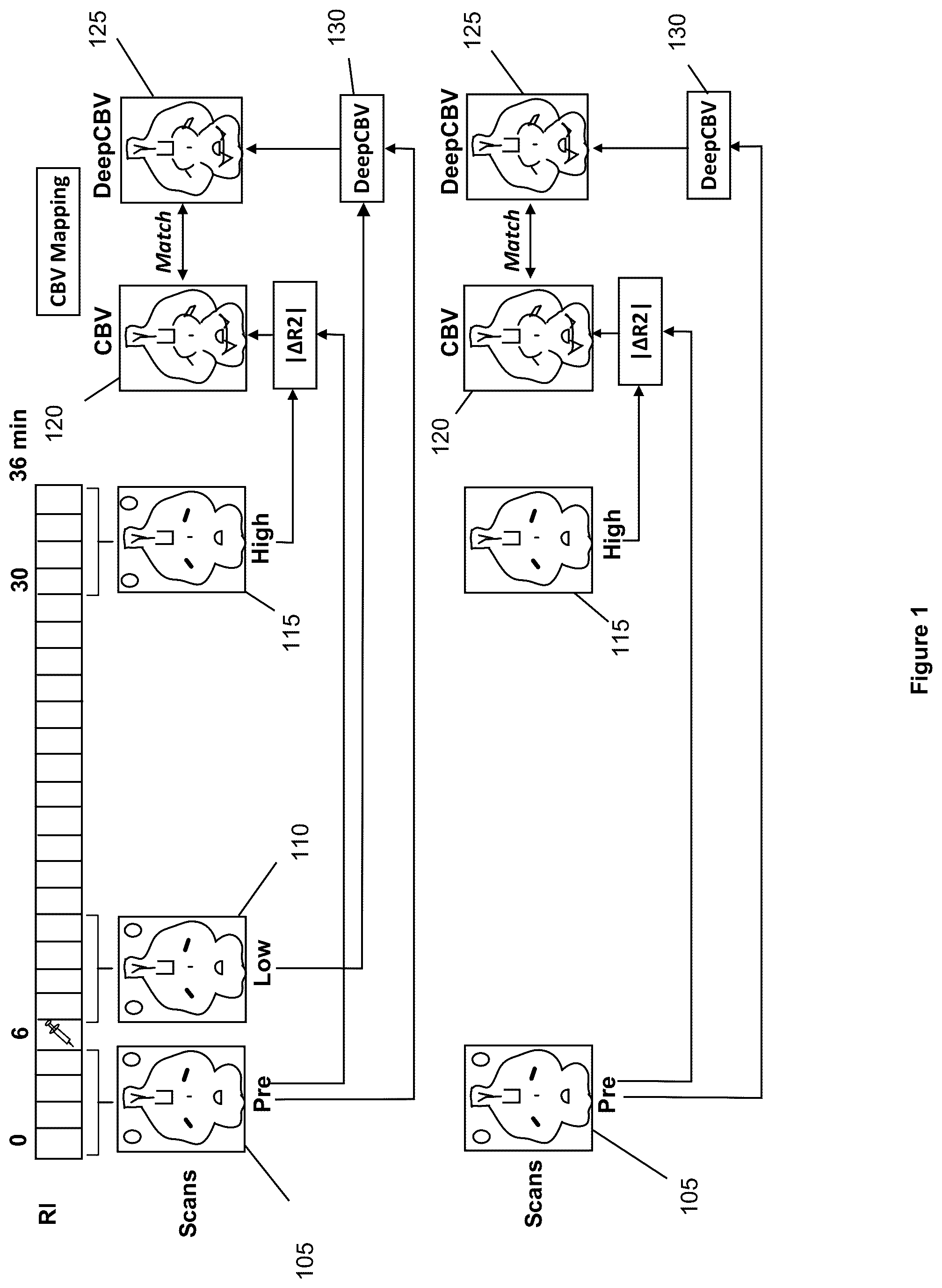 Patent US12100121 Figure 1 – System, method and computer-accessible medium for detecting structural disorder(s) using magnetic resonance imaging