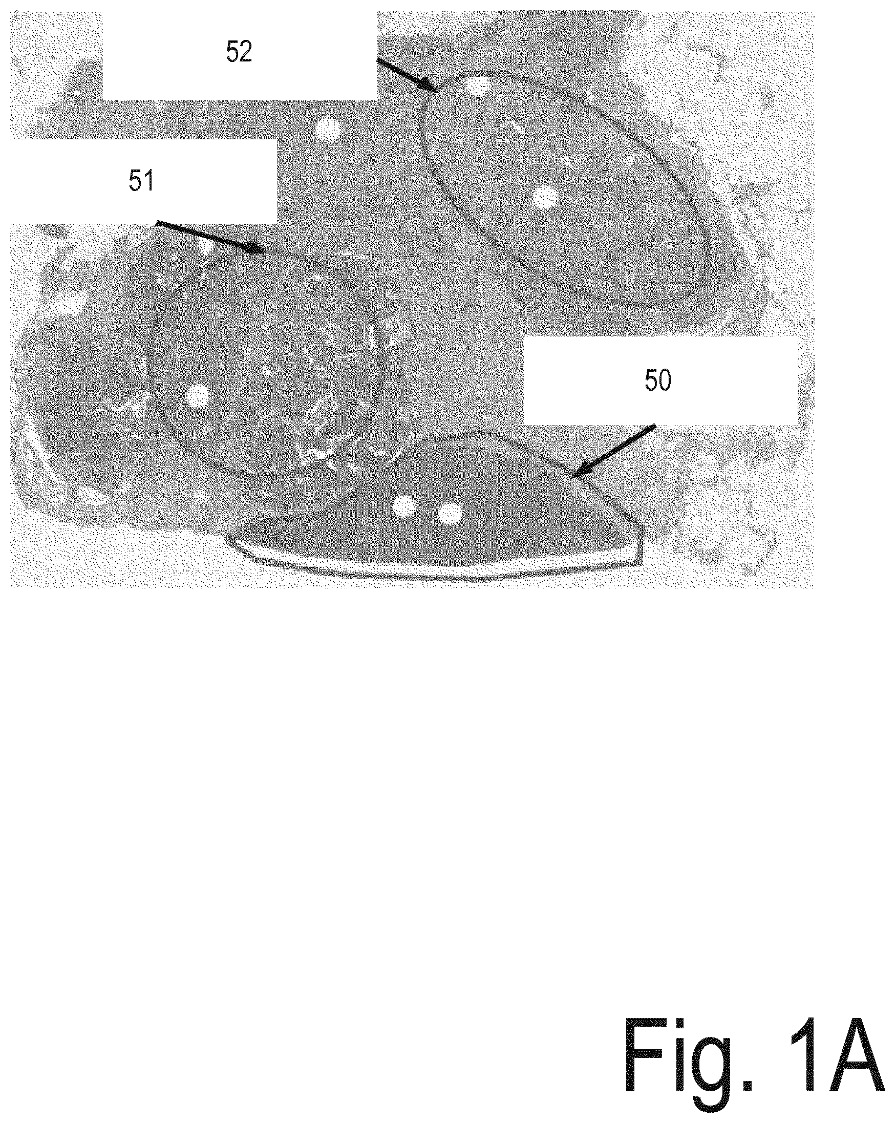 Patent US12100137 — System for analysis of microscopic data using graphs — Figure 1