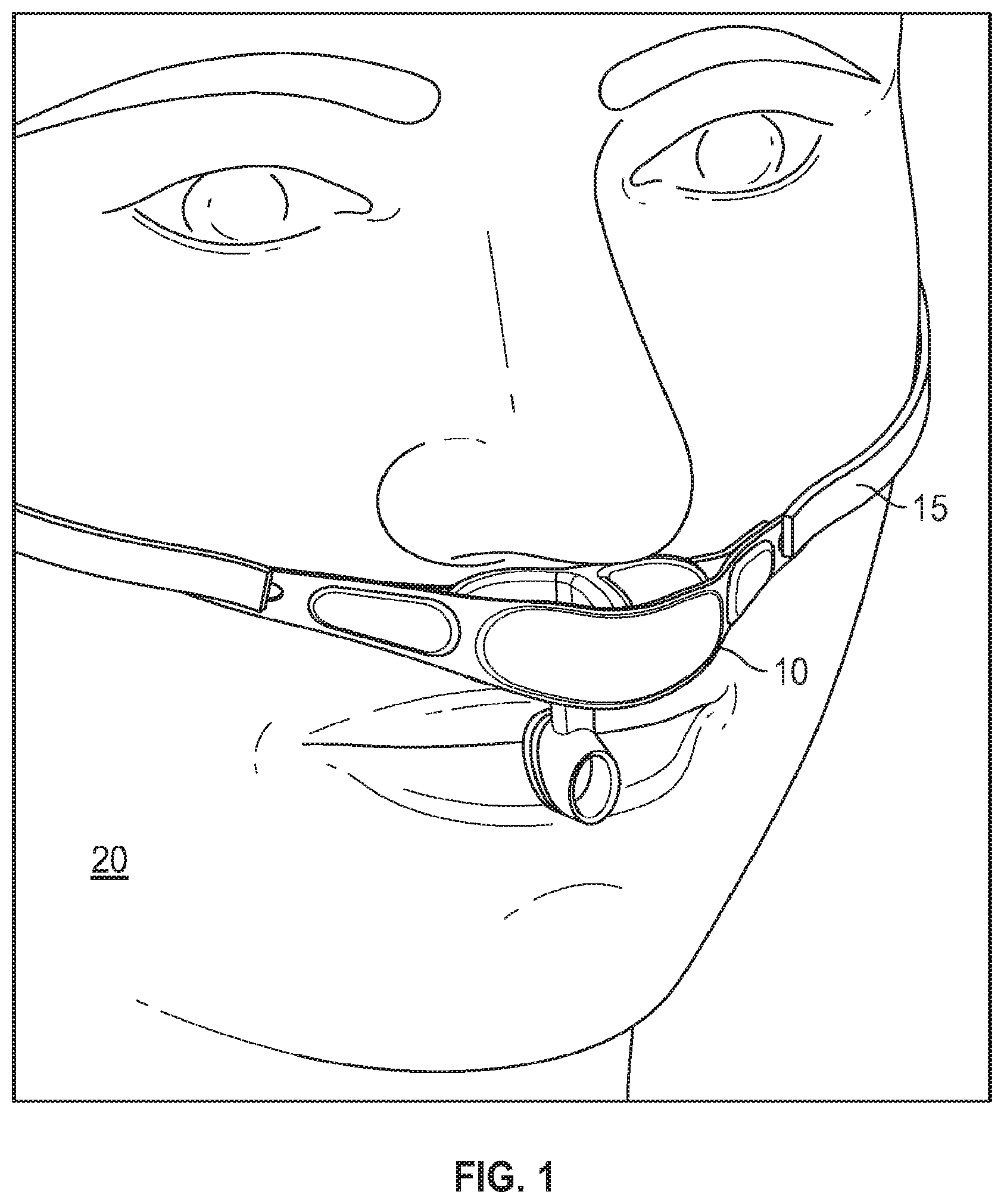 Patent US12100492 — Nasal and oral respiration sensor — Figure 1