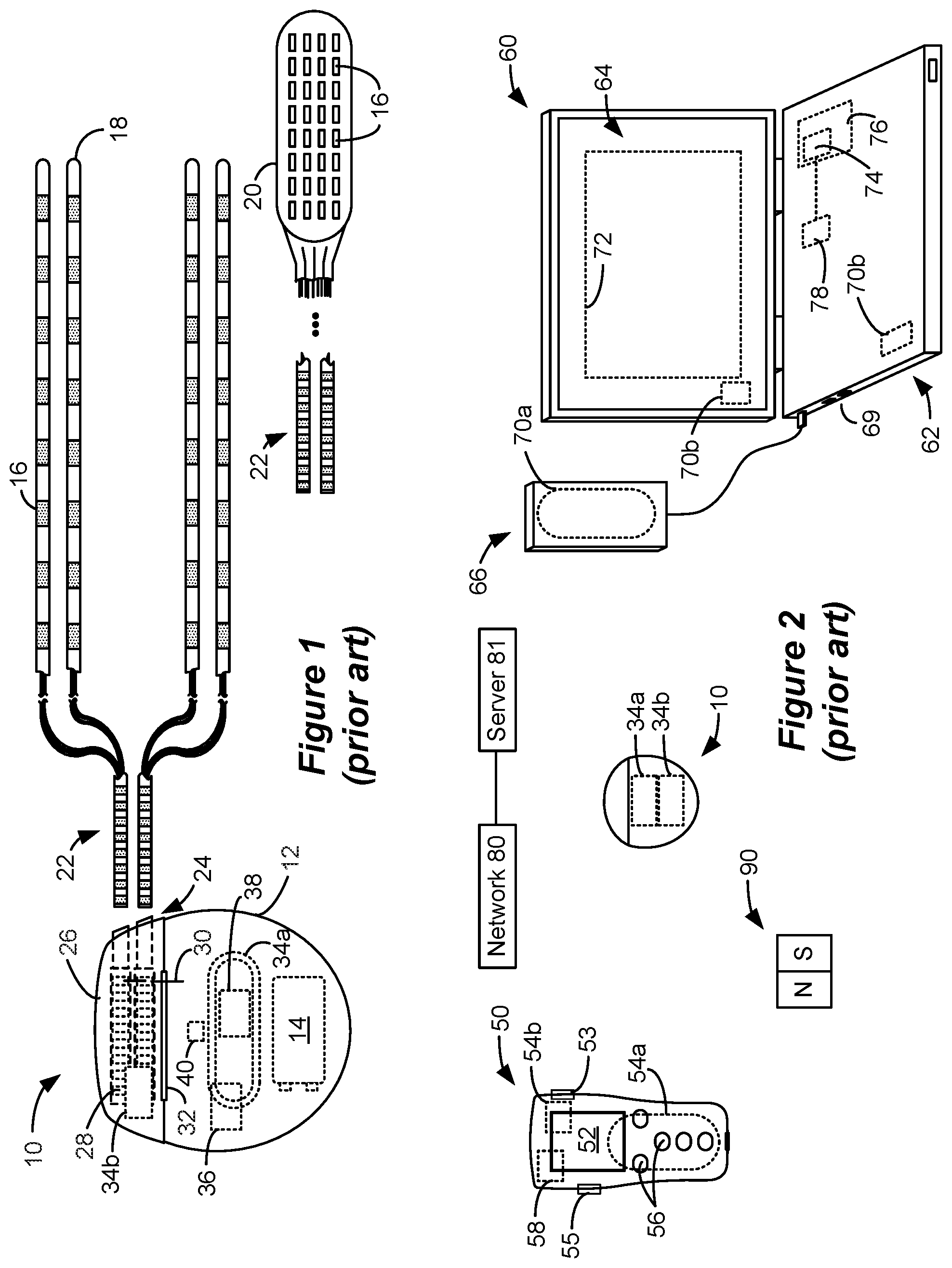 Patent US12101835 — Adjustment of advertising interval in communications between an implantable medical device and an external device — Figure 1