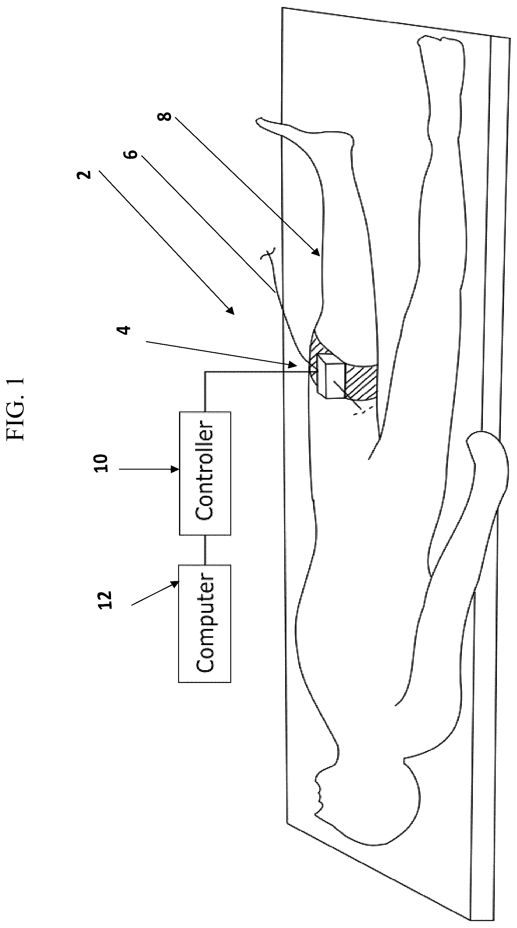 Patent US12102290 — Device for automatically inserting and manipulating a medical tool into and within a bodily lumen — Figure 1