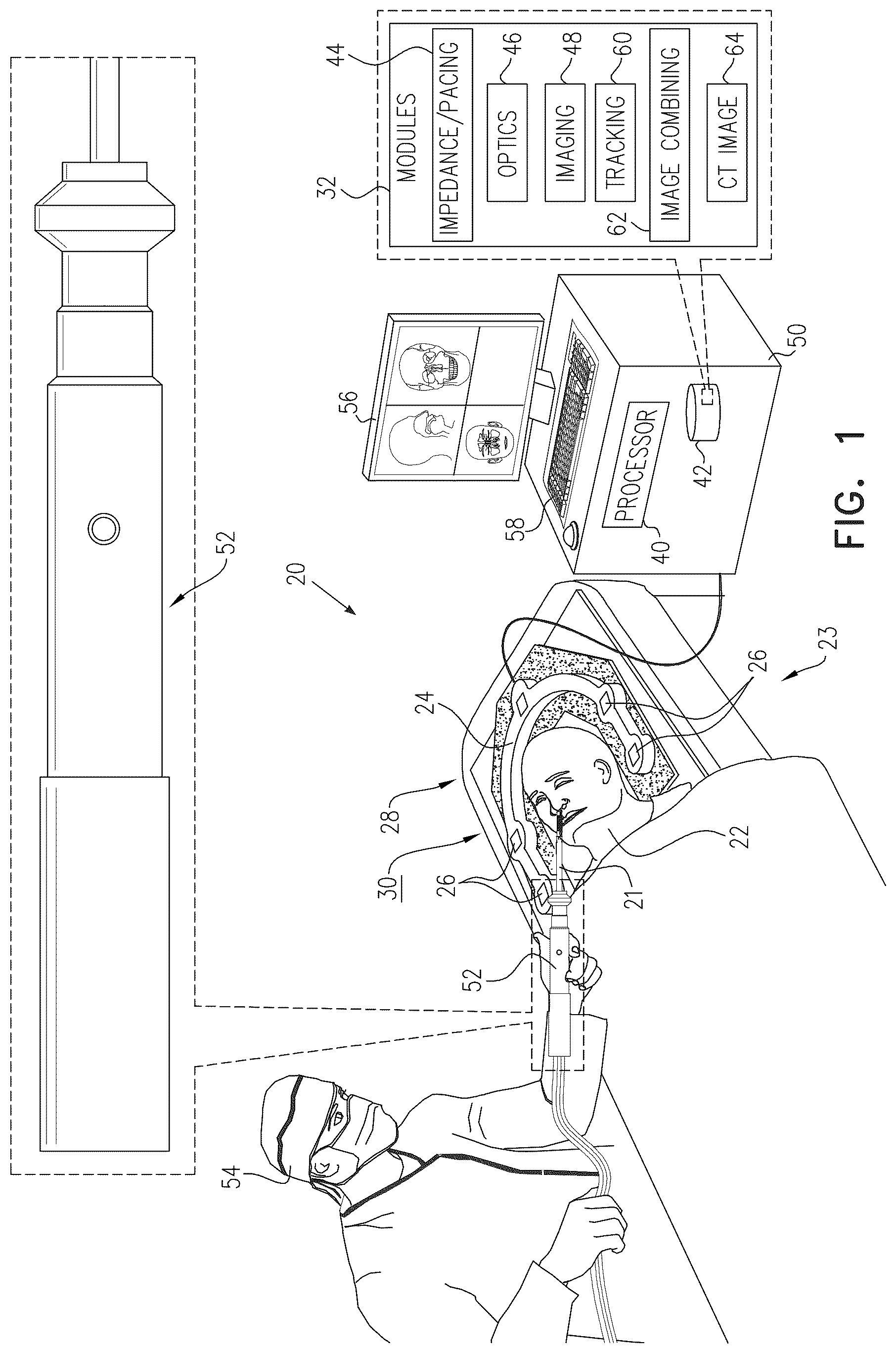 Patent US12102293 — ENT guidewire — Figure 1