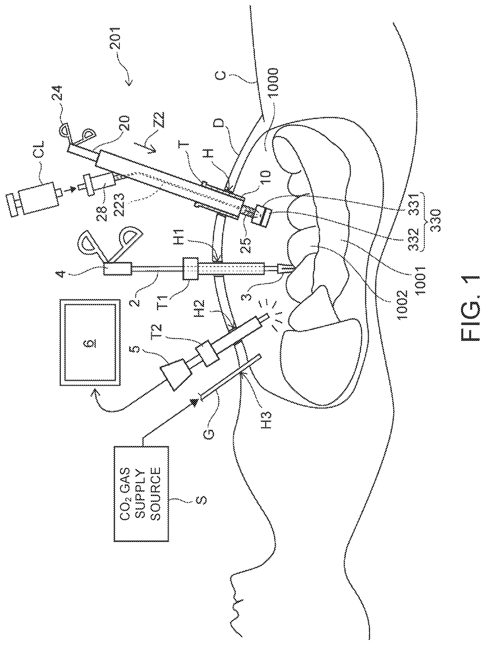 Patent US12102311 — Organ retraction device — Figure 1