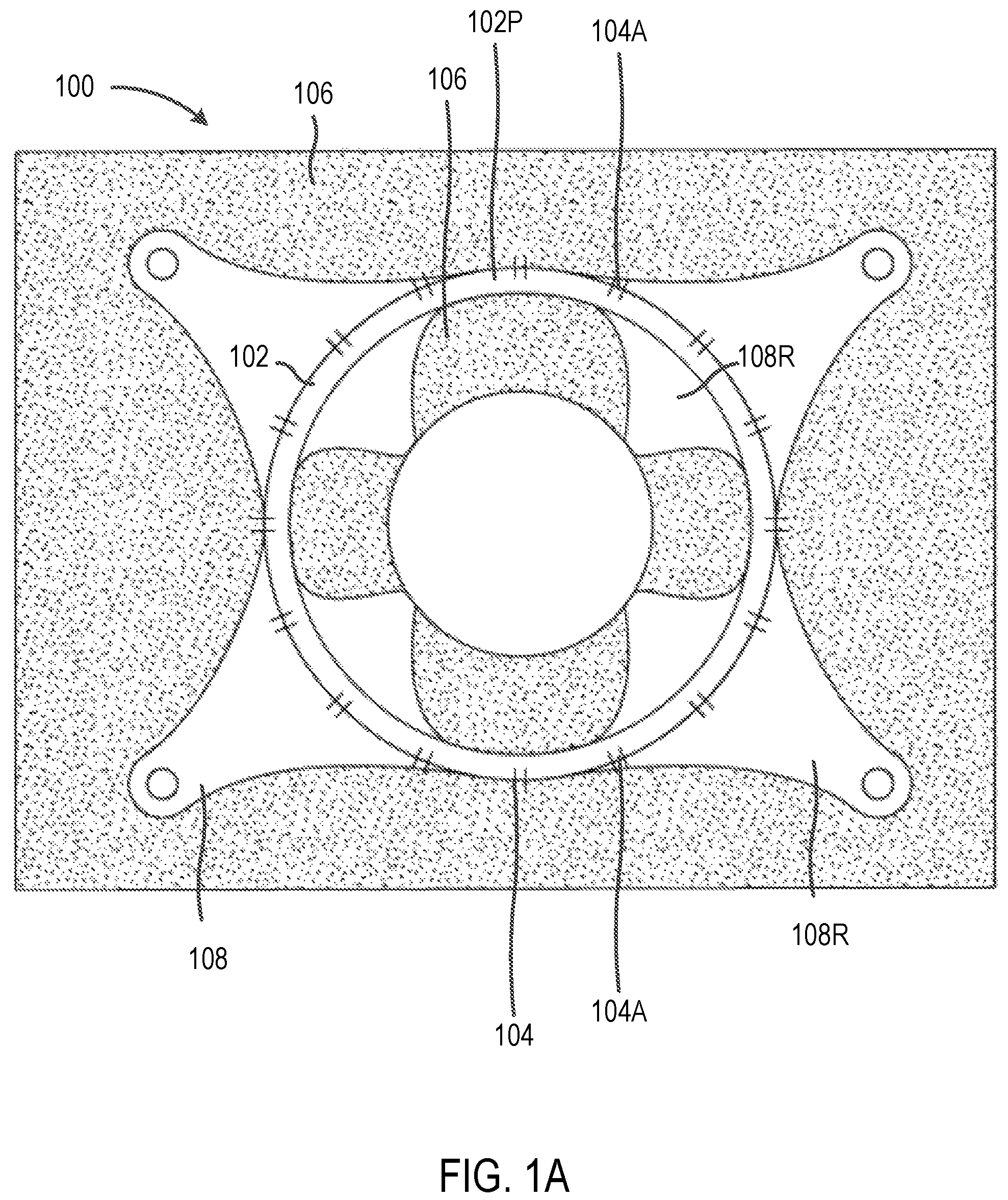 Patent US12102314 — Systems and methods including an adjustable retractor frame — Figure 1