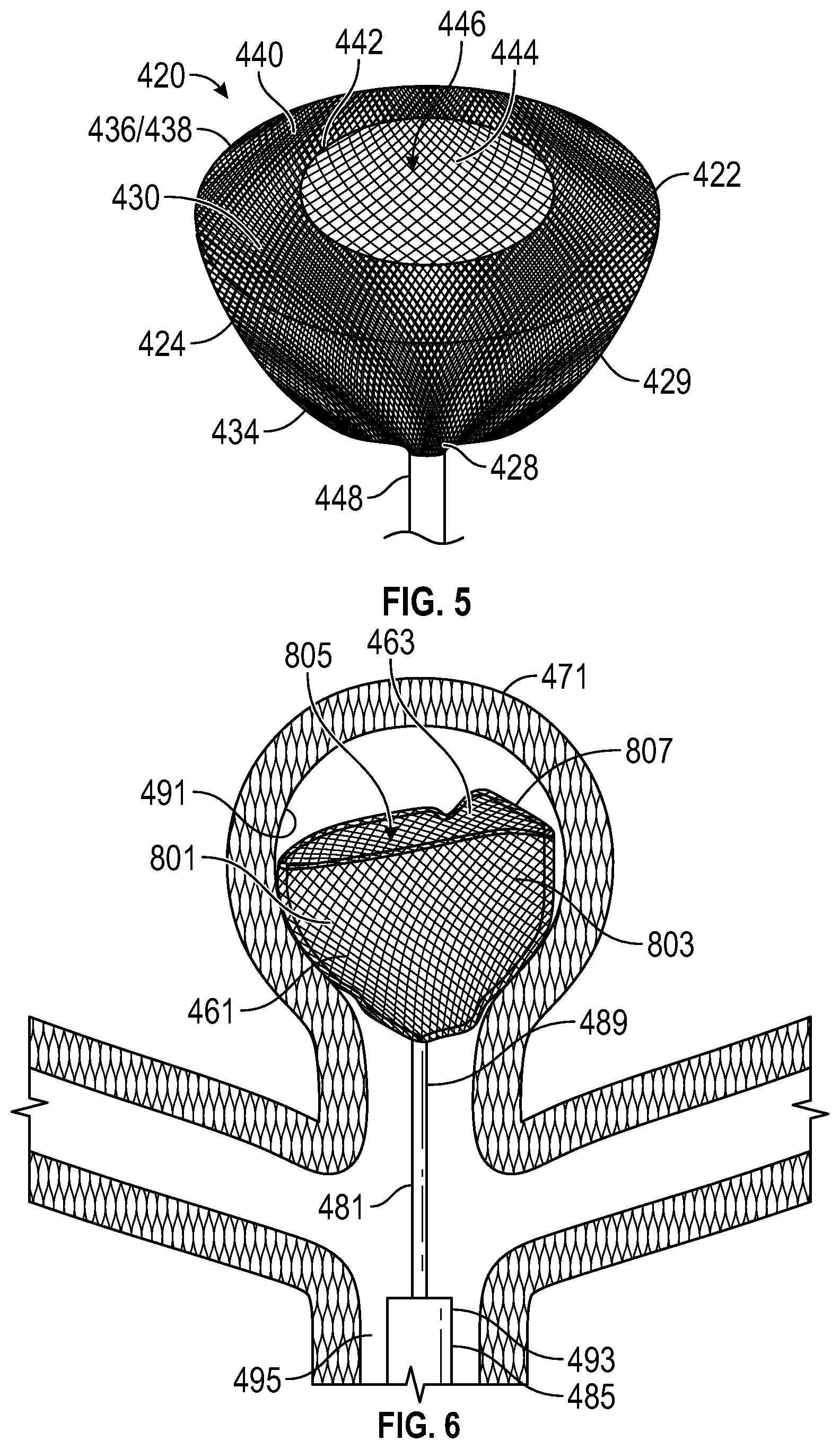 Patent US12102327 Figure 2 – Systems and methods for treating aneurysms