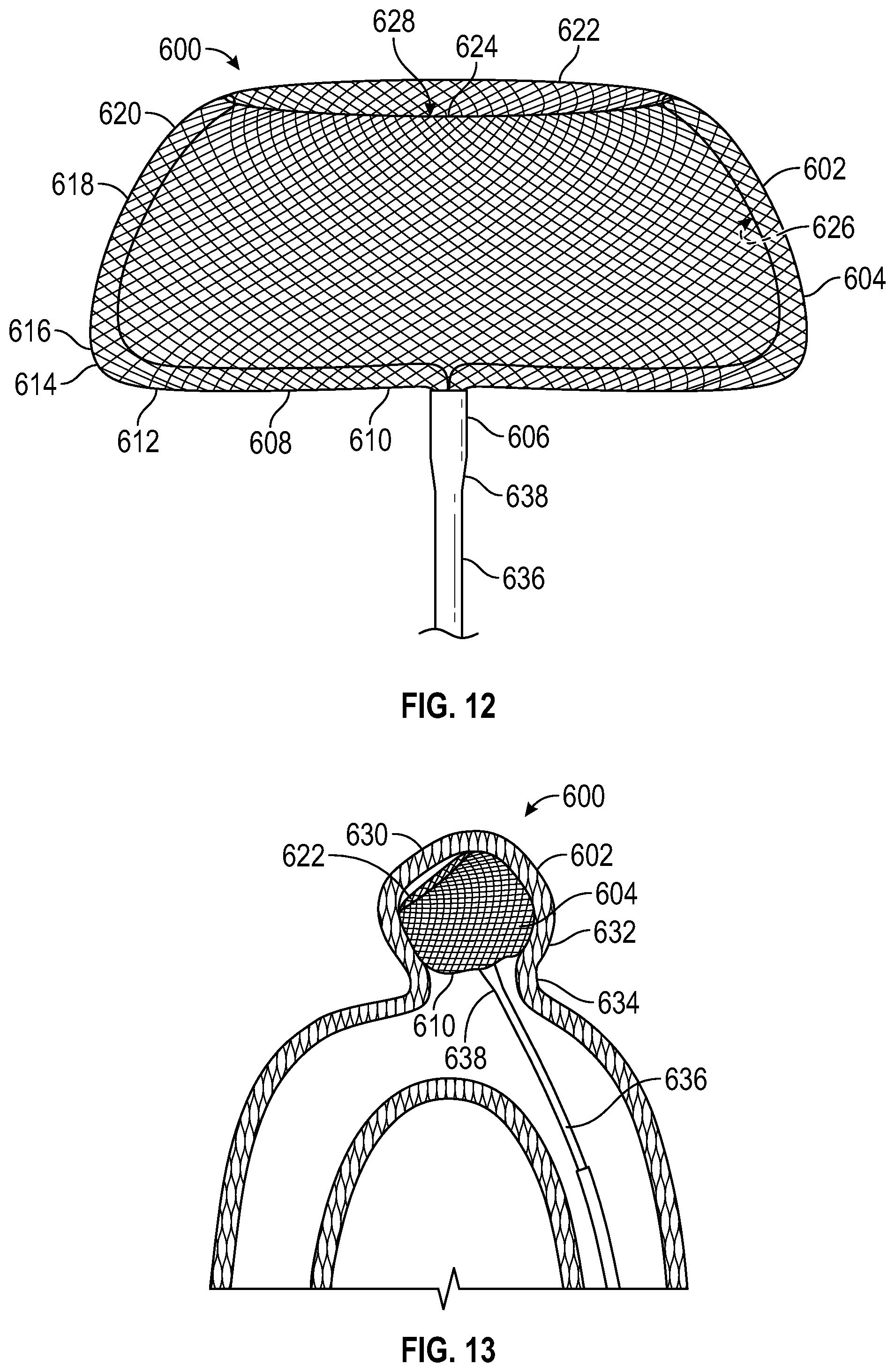 Patent US12102327 Figure 6 – Systems and methods for treating aneurysms
