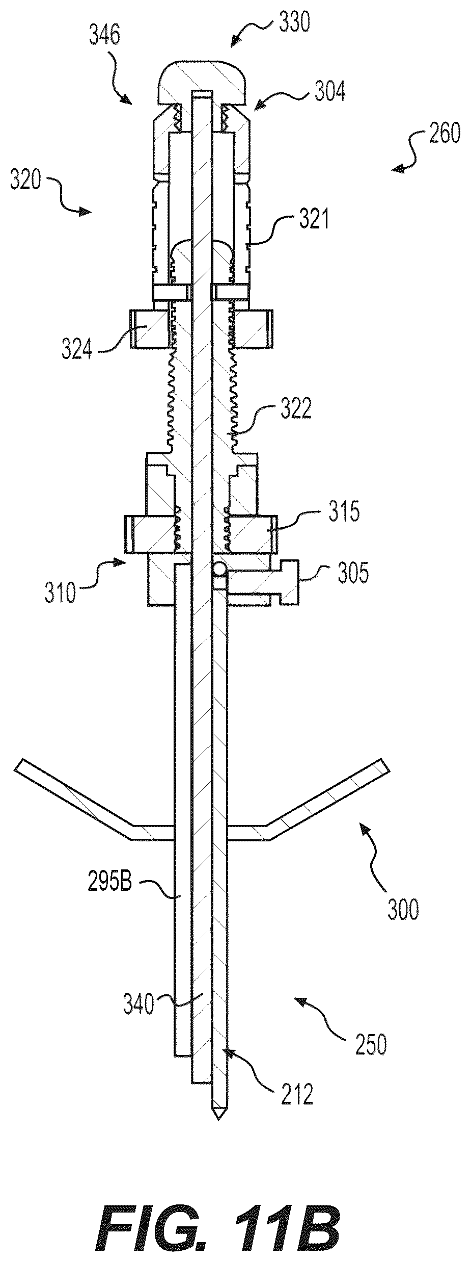 Patent US12102348 Figure 20 – Percutaneous lateral recess resection methods and instruments