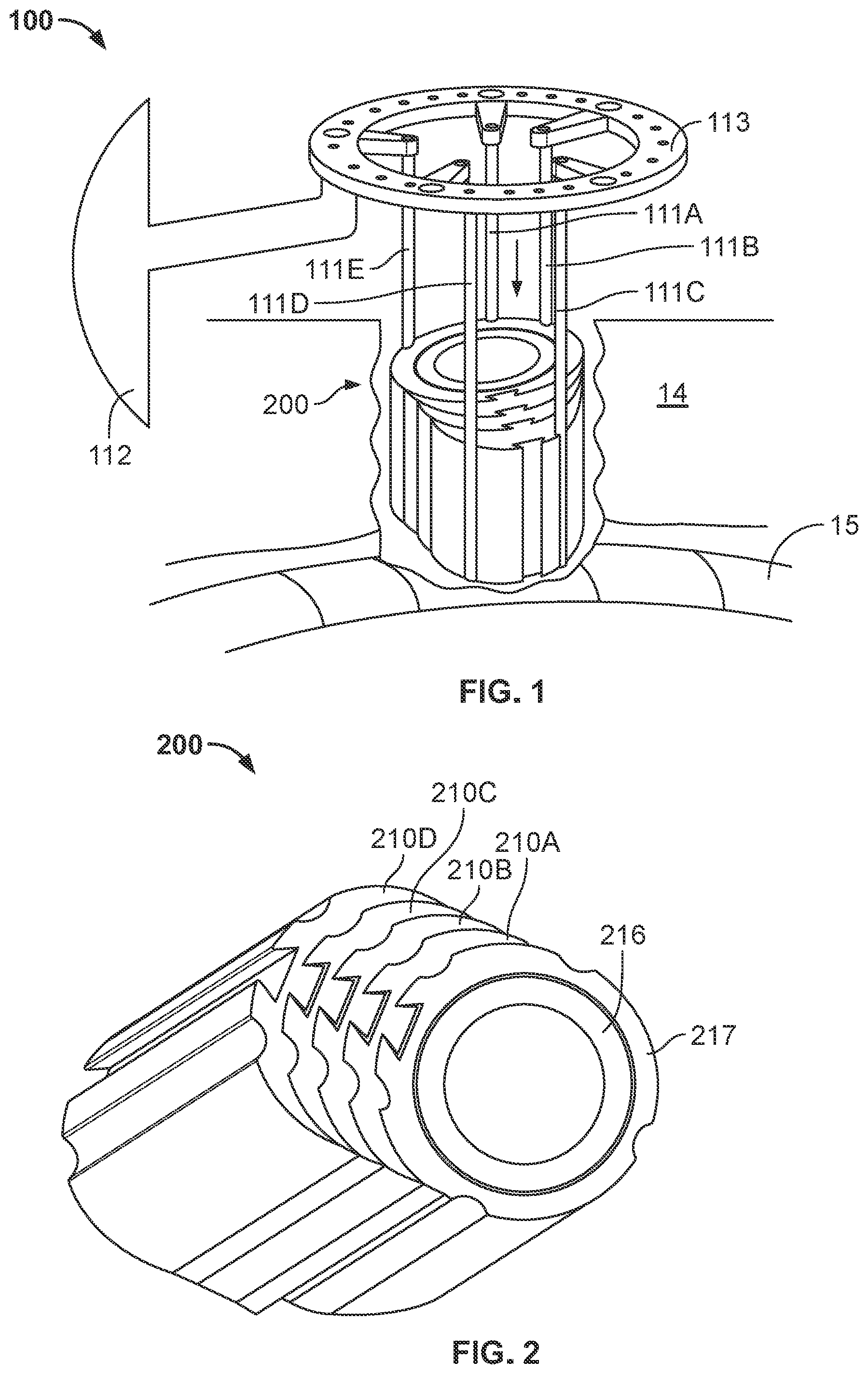 Patent US12102353 — Expanders for rod retraction — Figure 1