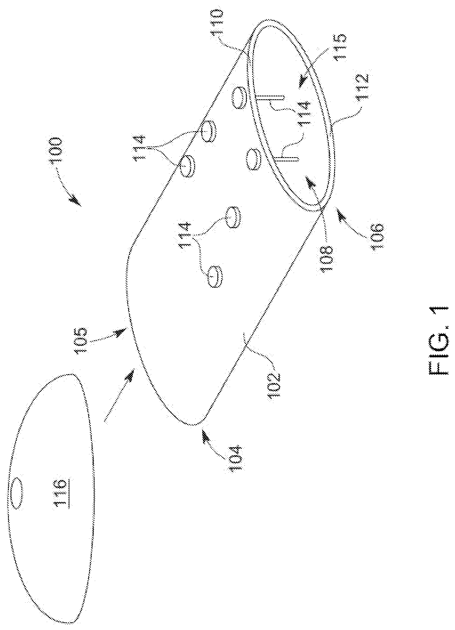 Patent US12102354 — Implant delivery sleeves having non-tapered tubular walls with constricted implant delivery channels for inserting implants into tissue pockets — Figure 1