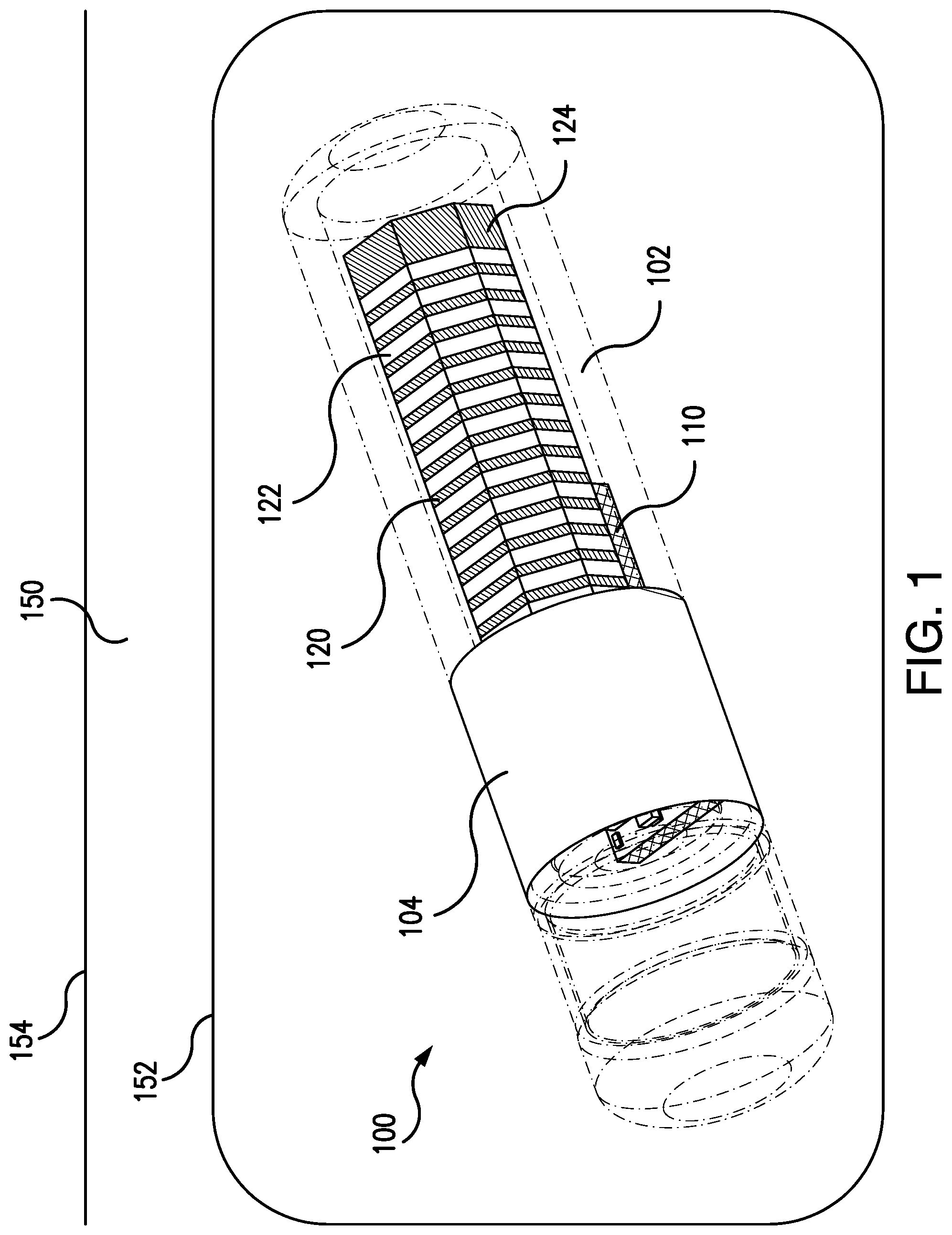 Patent US12102356 — Removal tool for a subcutaneous implantable device — Figure 1