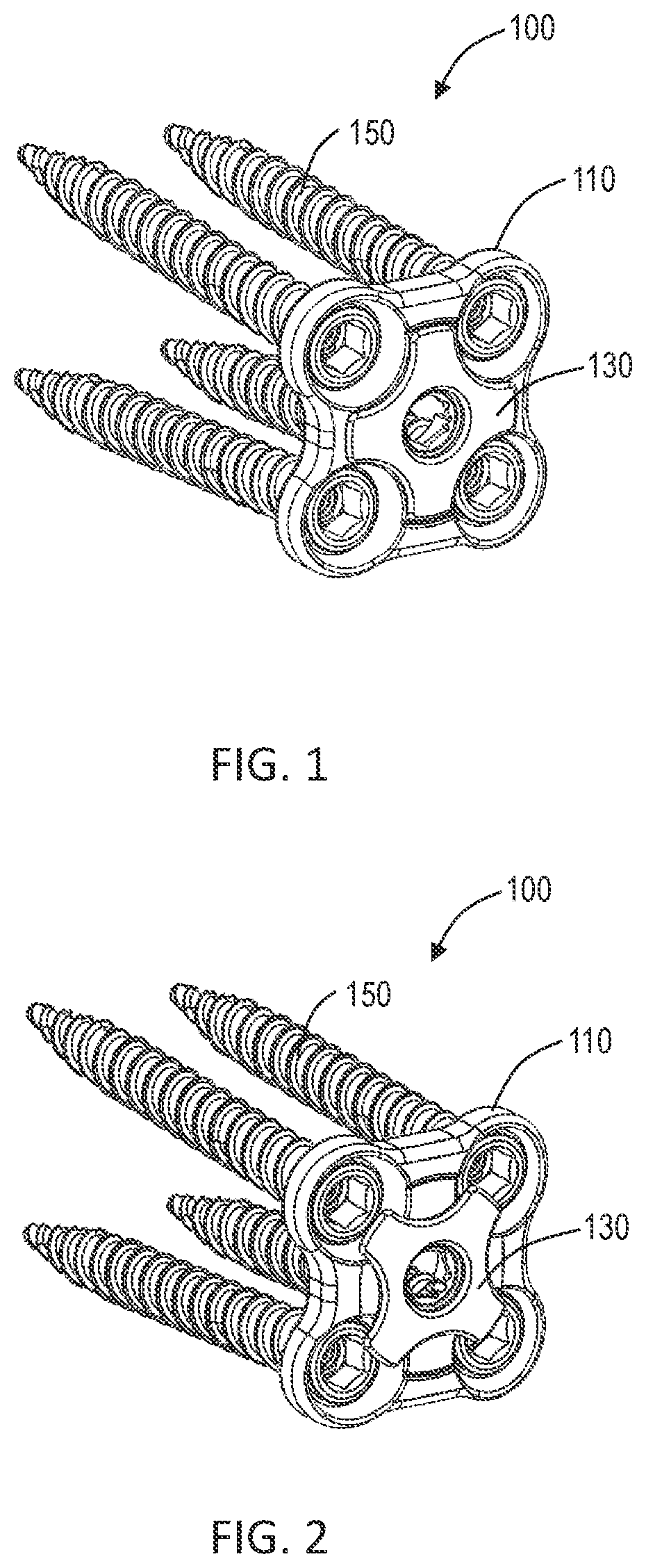 Patent US12102358 — Lateral vertebral lumbar plate system with integrated rotational control mechanism for screw retention — Figure 1