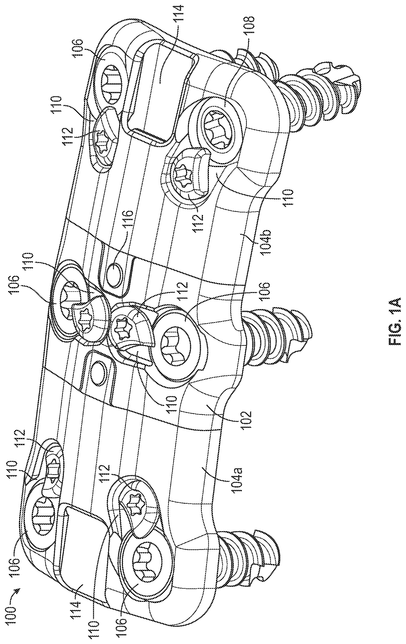 Patent US12102360 — Compressible cervical plate — Figure 1