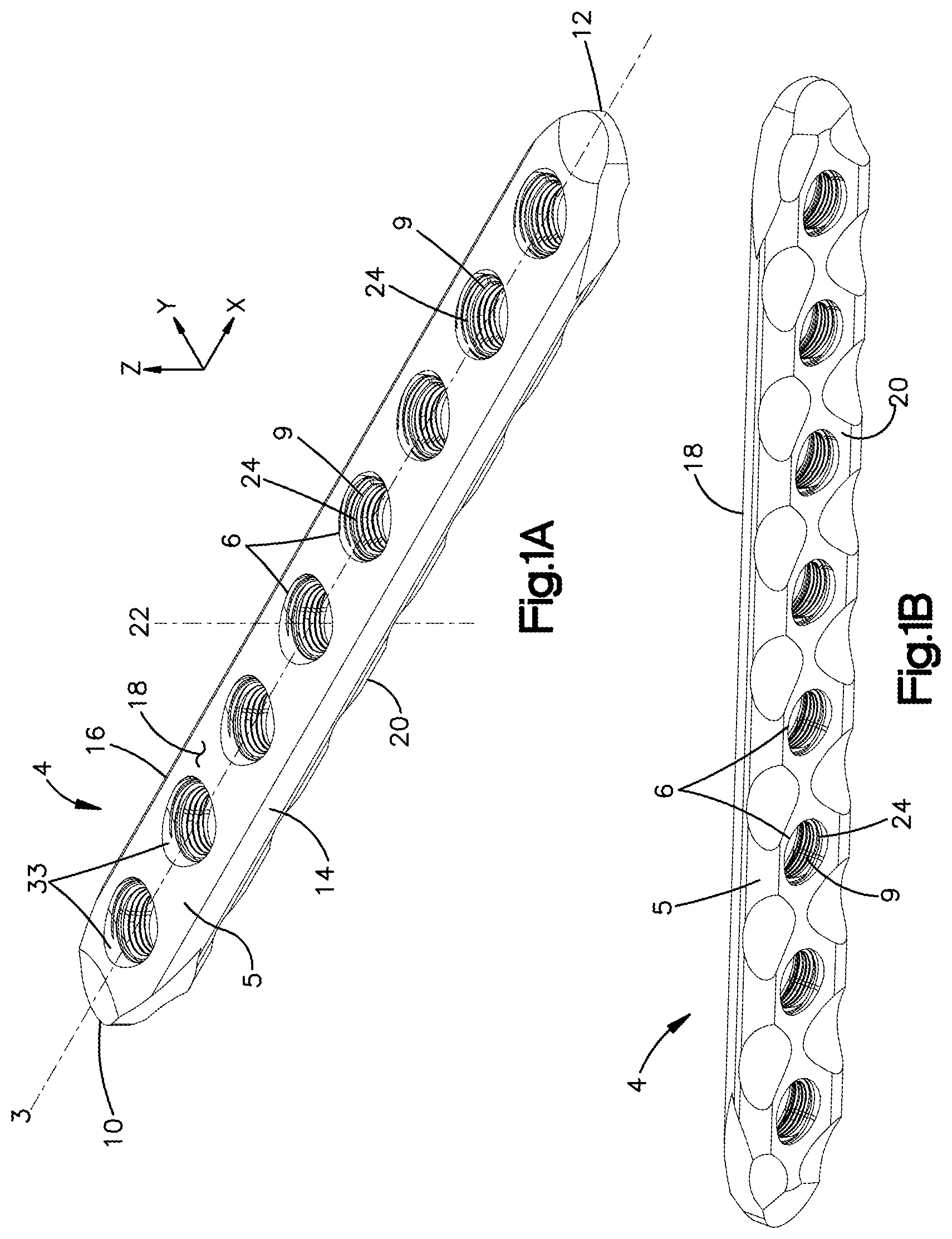Patent US12102361 — Bone plates having multi-use screw holes for locking and compression screws, and related systems and methods — Figure 1