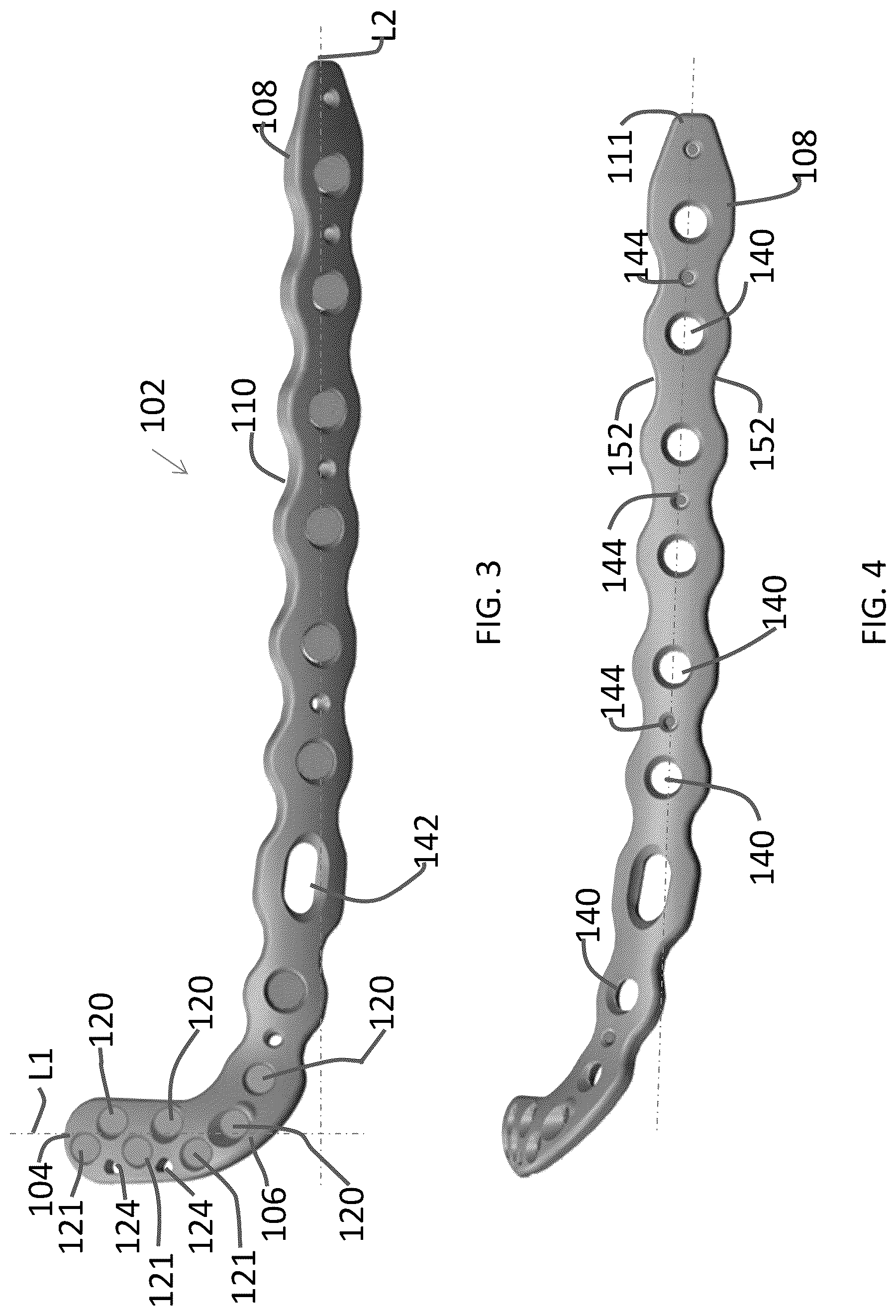 Patent US12102363 Figure 2 – Distal tibial plating system