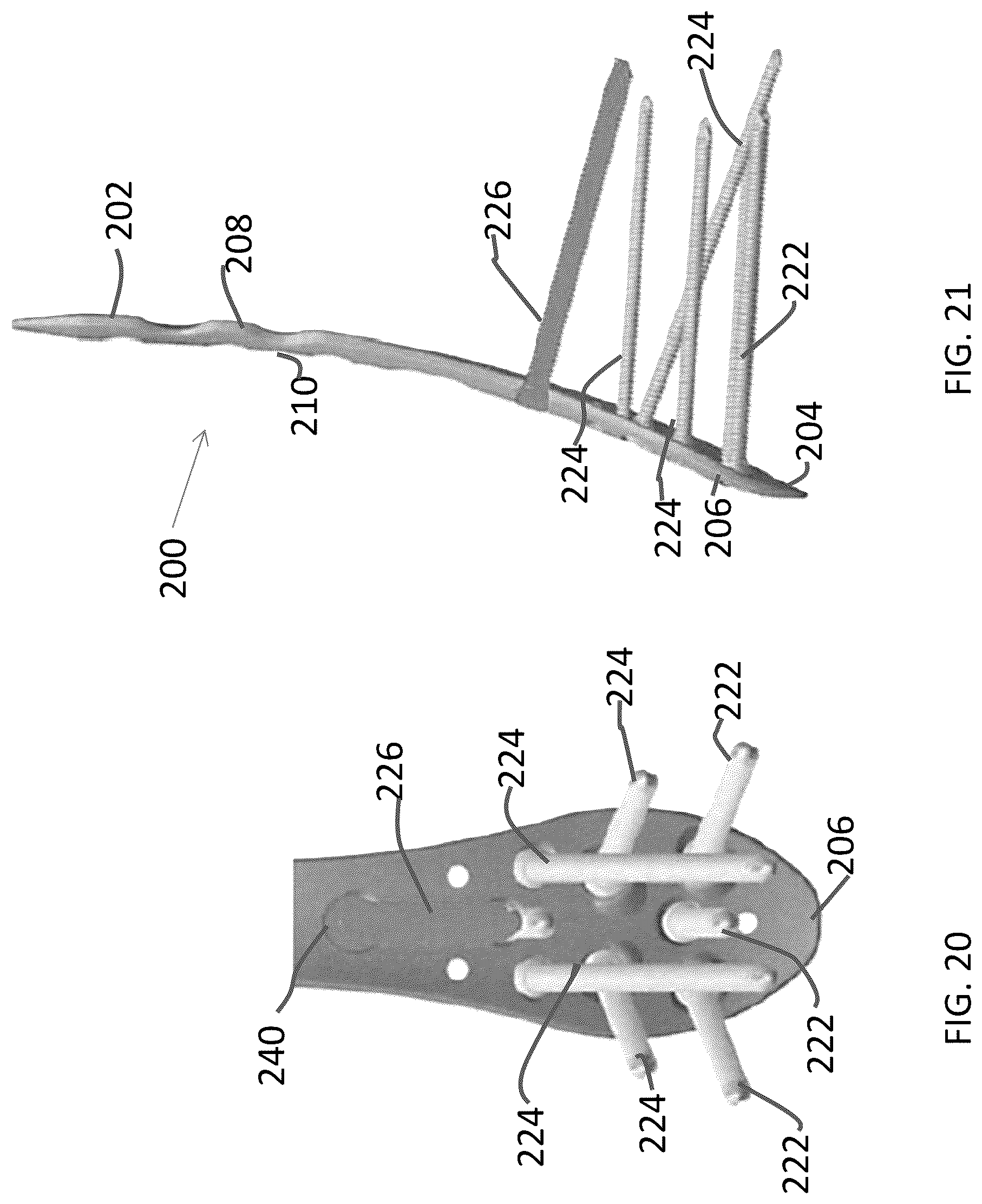 Patent US12102363 Figure 9 – Distal tibial plating system