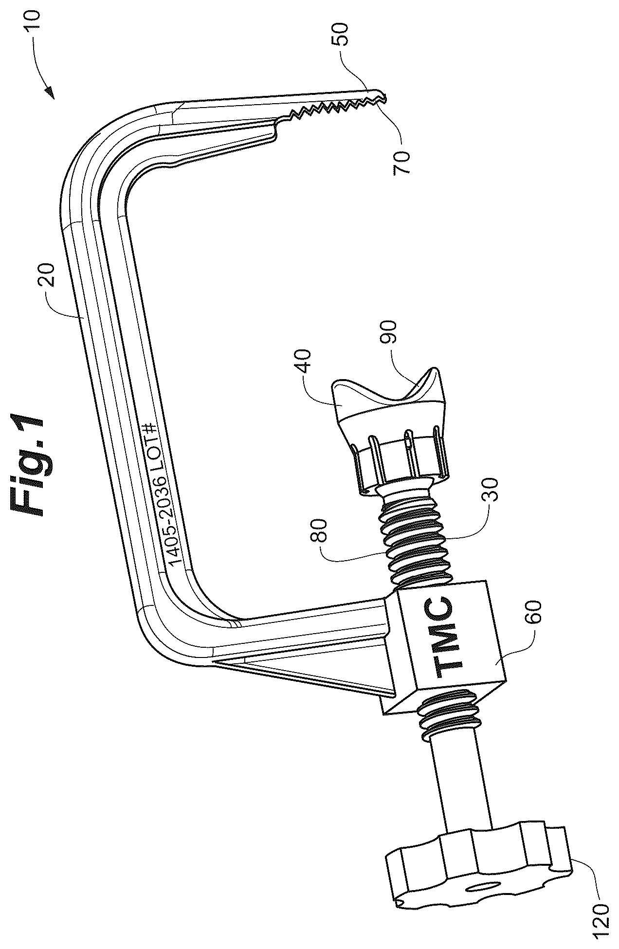 Patent US12102368 Figure 1 – Bone positioning guide