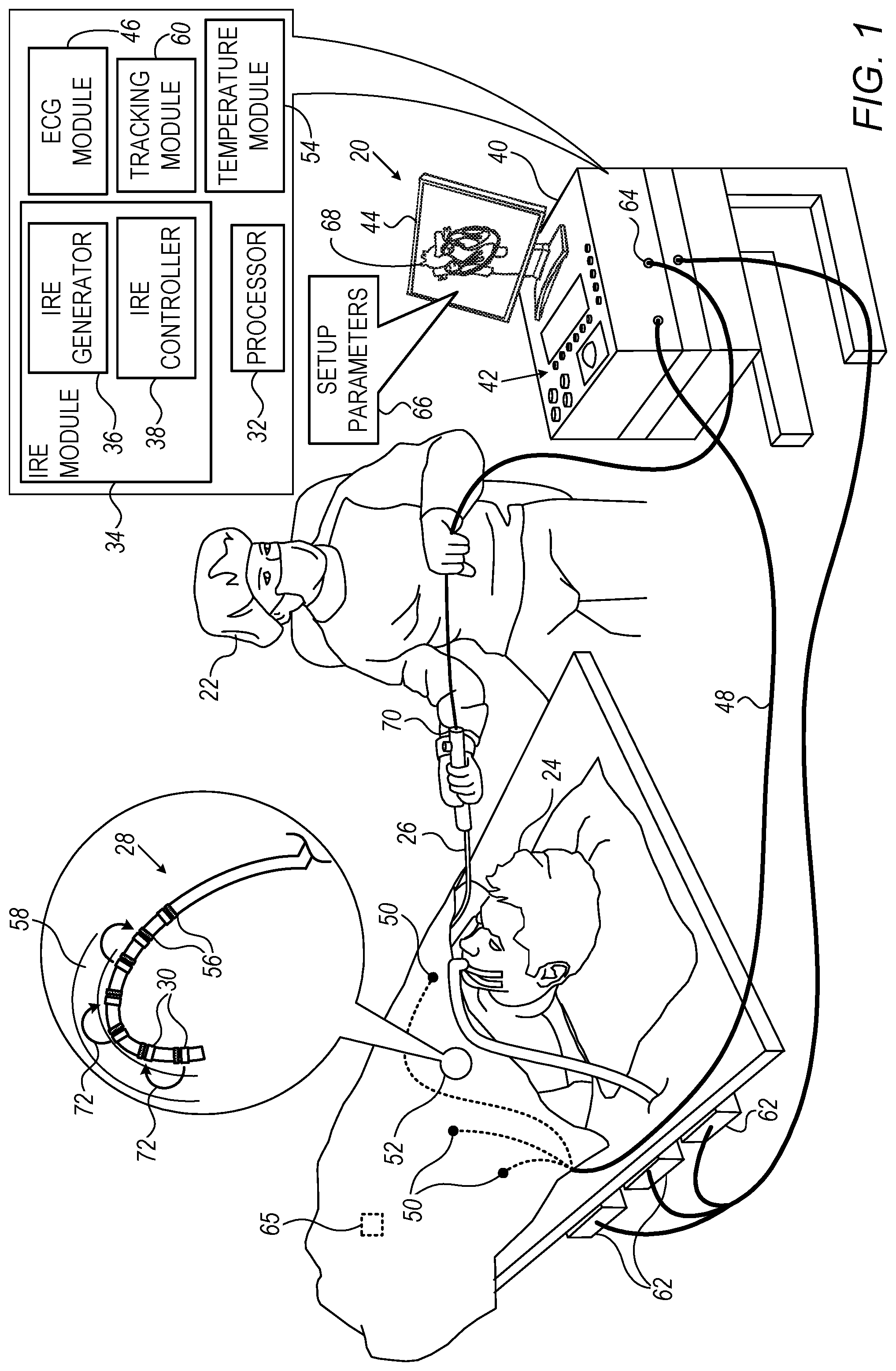 Patent US12102374 Figure 1 – Pulse generator for irreversible electroporation with switchable pulse application