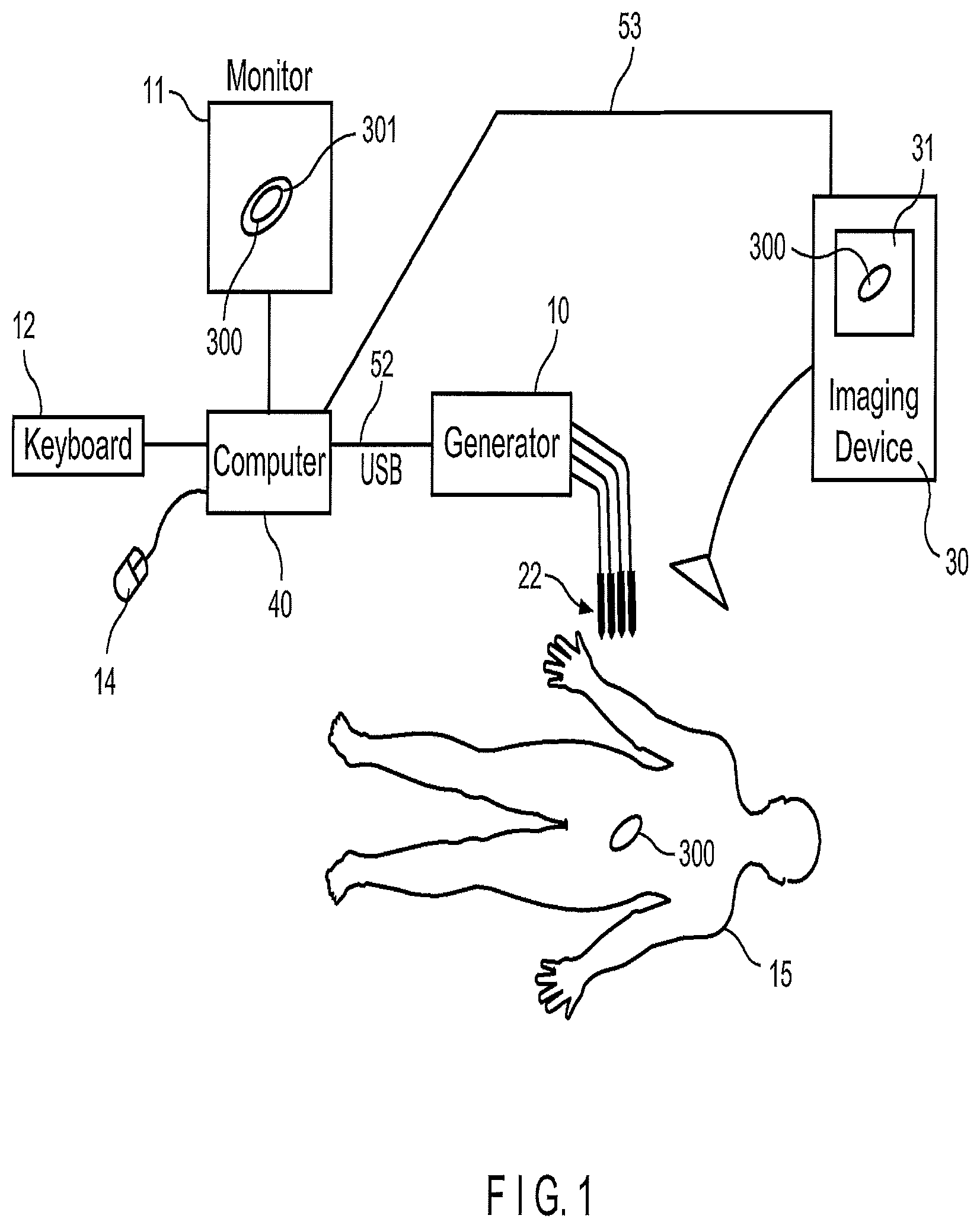 Patent US12102376 Figure 1 – System and method for increasing a target zone for electrical ablation