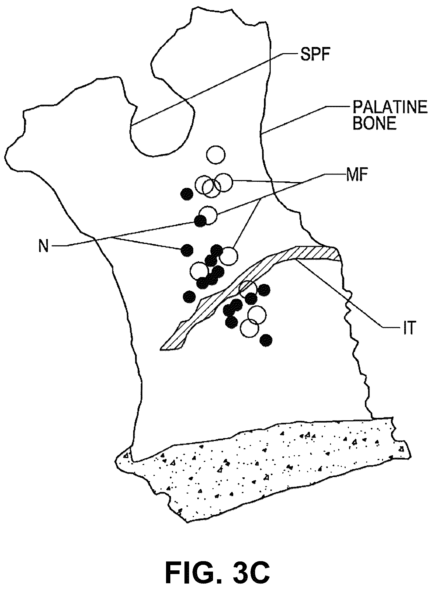 Patent US12102379 Figure 5 – Systems and methods for therapeutic nasal treatment using handheld device