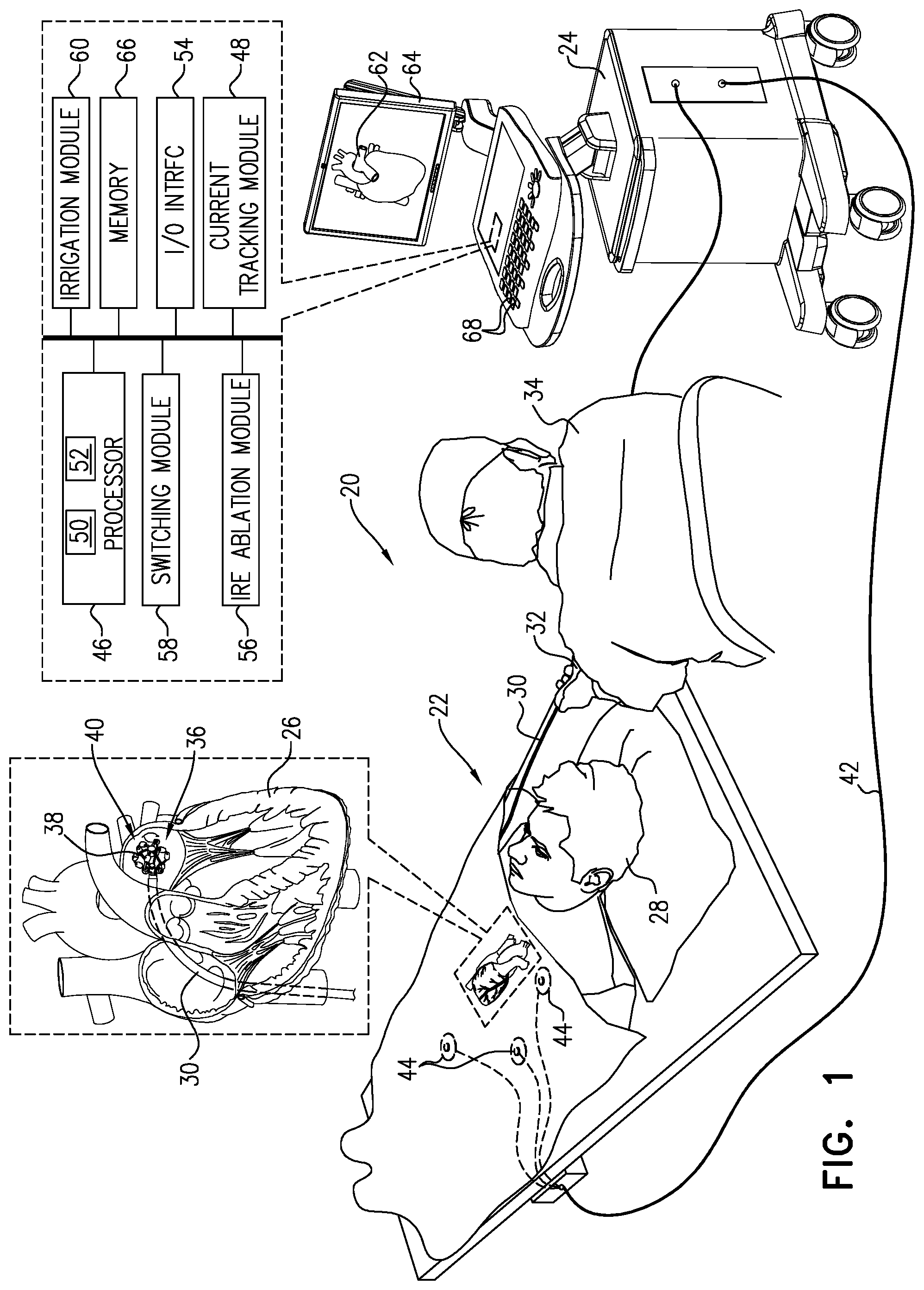 Patent US12102382 — Biased electrodes for improved tissue contact and current delivery — Figure 1