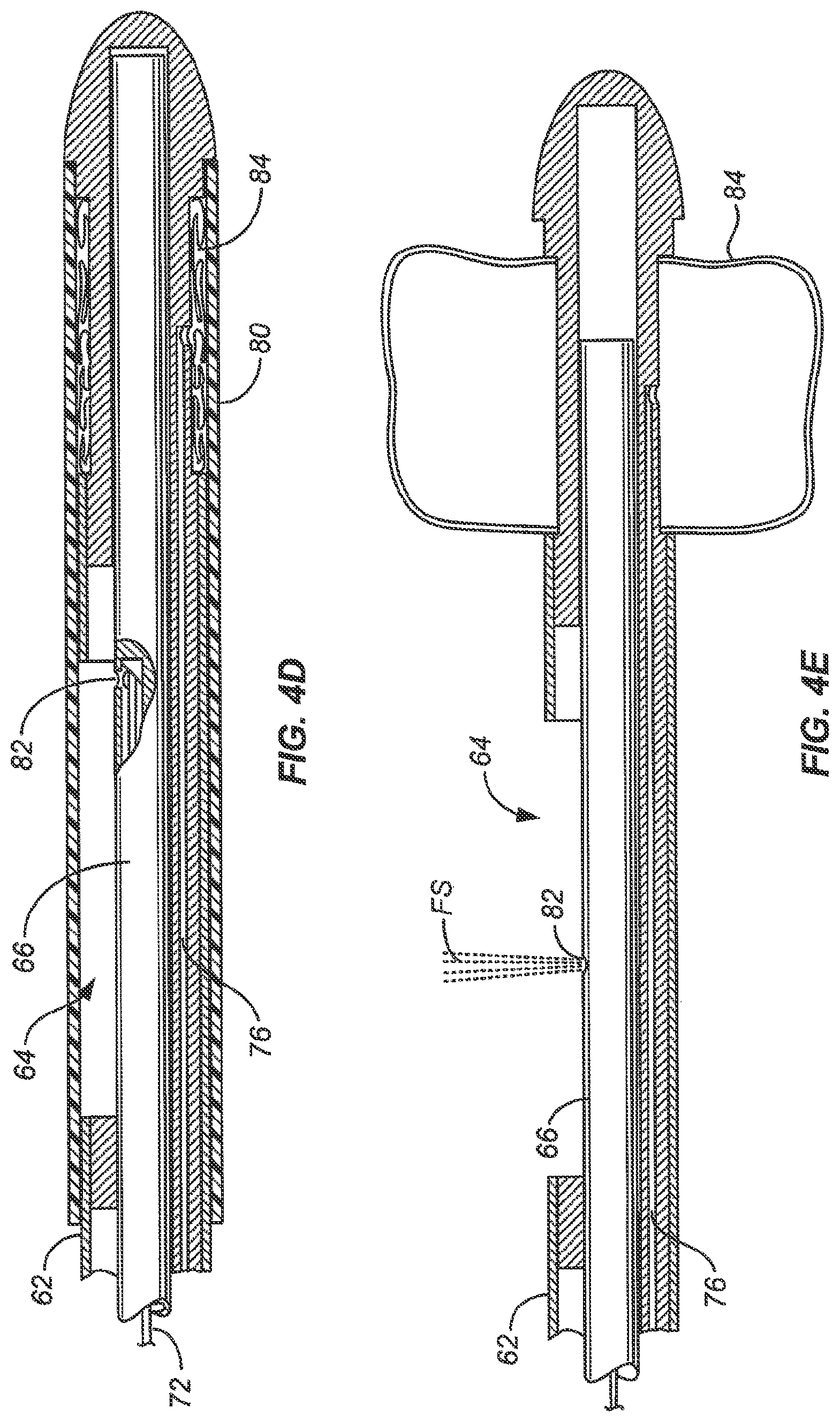 Patent US12102383 Figure 7 – Tissue resection device with motors and control circuitry