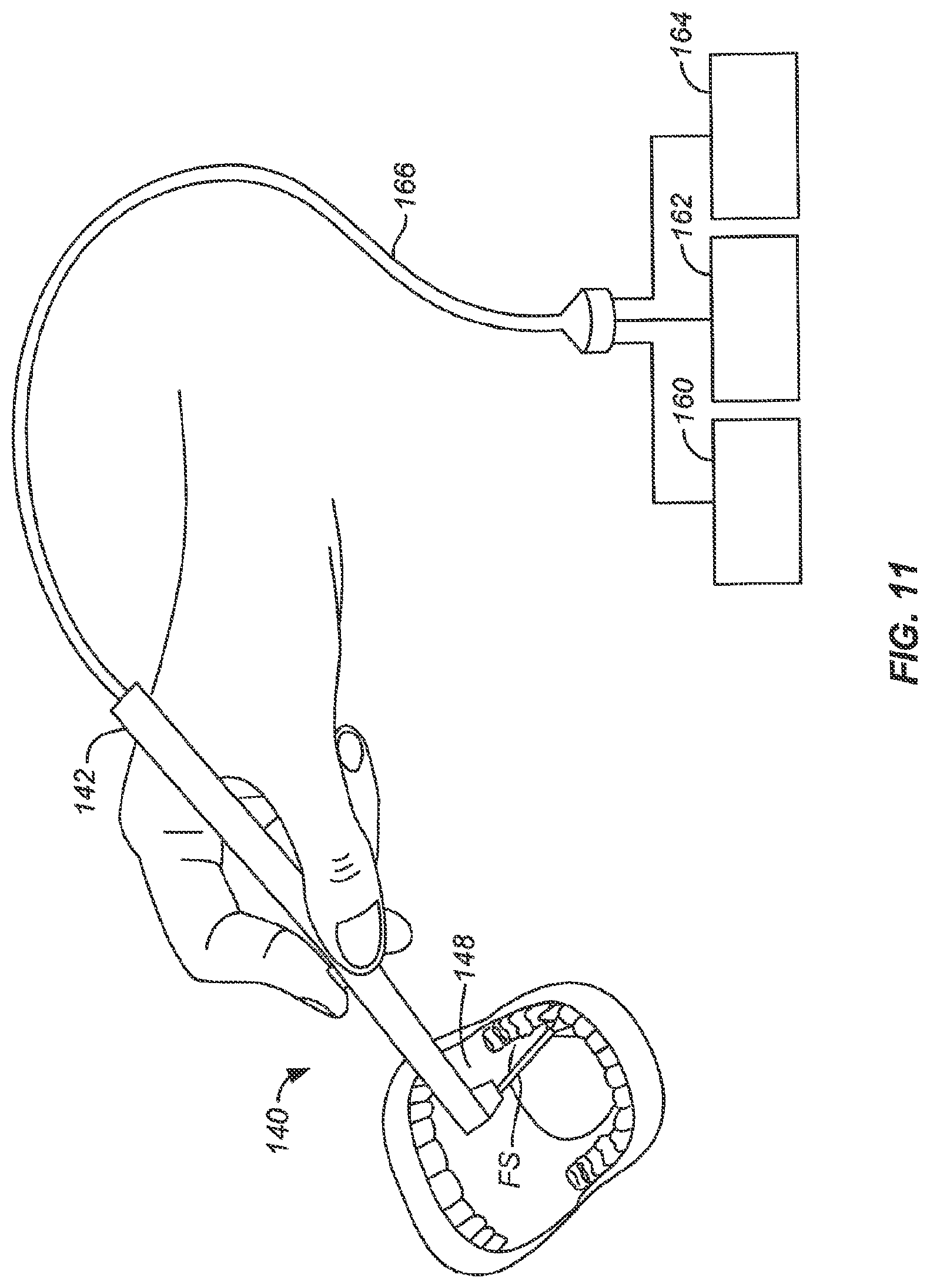 Patent US12102383 Figure 11 – Tissue resection device with motors and control circuitry