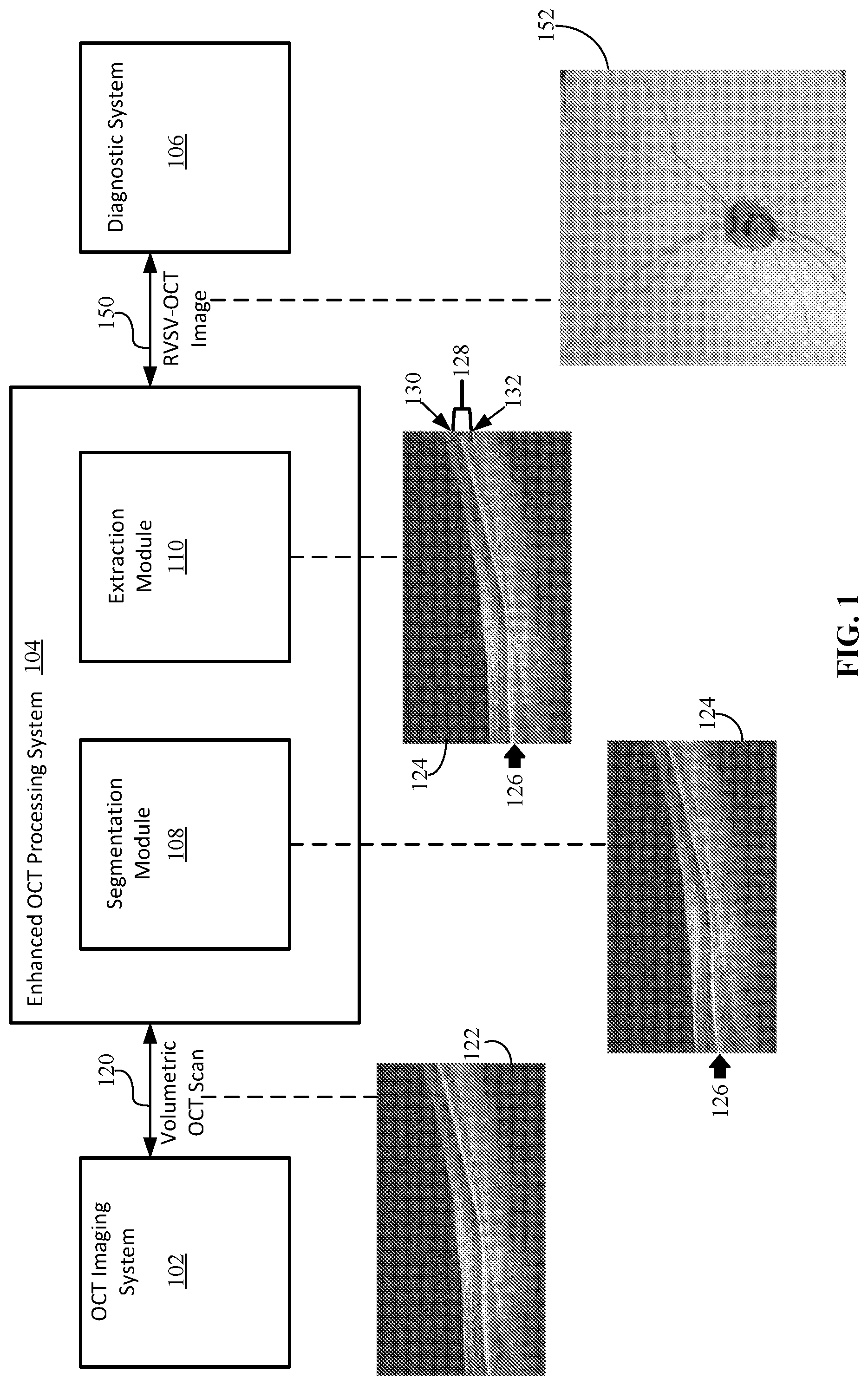 Patent US12102389 — En face retinal vessel shadow view optical coherence tomography images — Figure 1