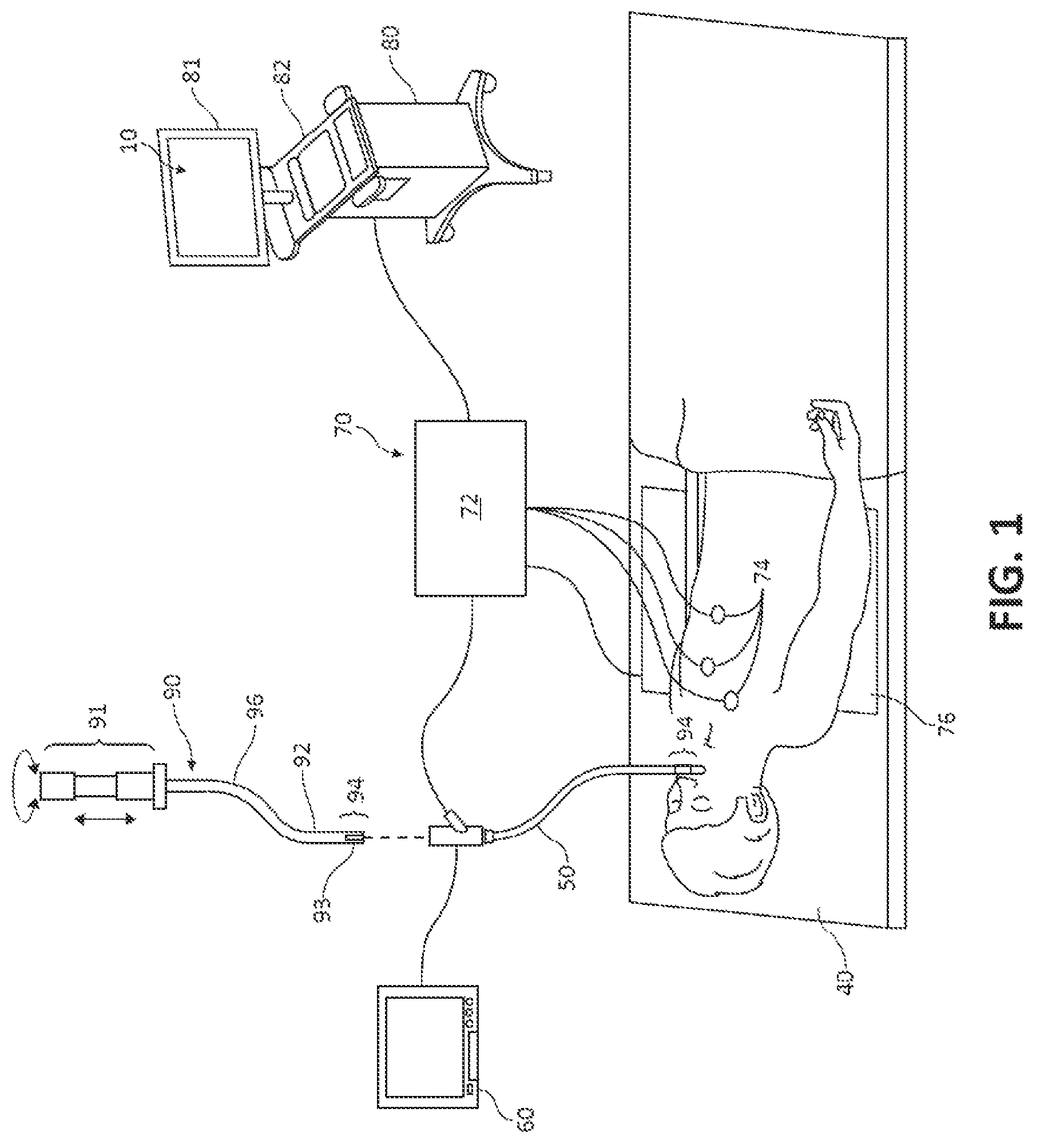 Patent US12102396 — Systems and methods for navigational bronchoscopy and selective drug delivery — Figure 1