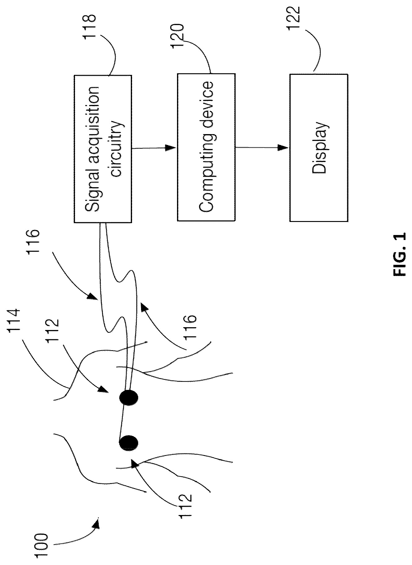 Patent US12102440 — Method and system for measuring cardiac electrogram depolarization voltage — Figure 1
