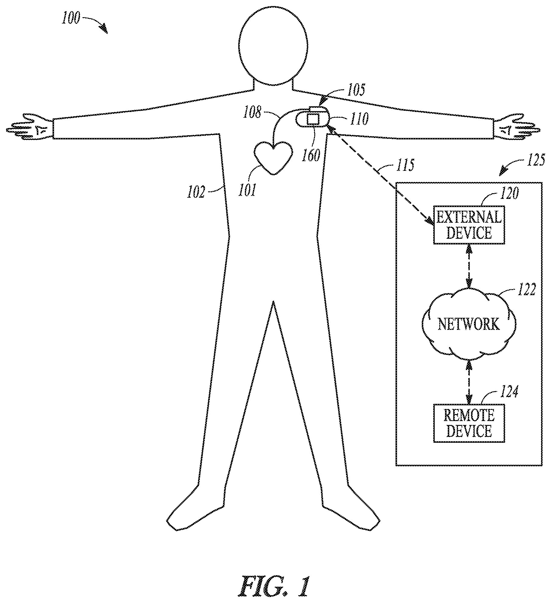 Patent US12102448 — Systems and methods for patient monitoring — Figure 1