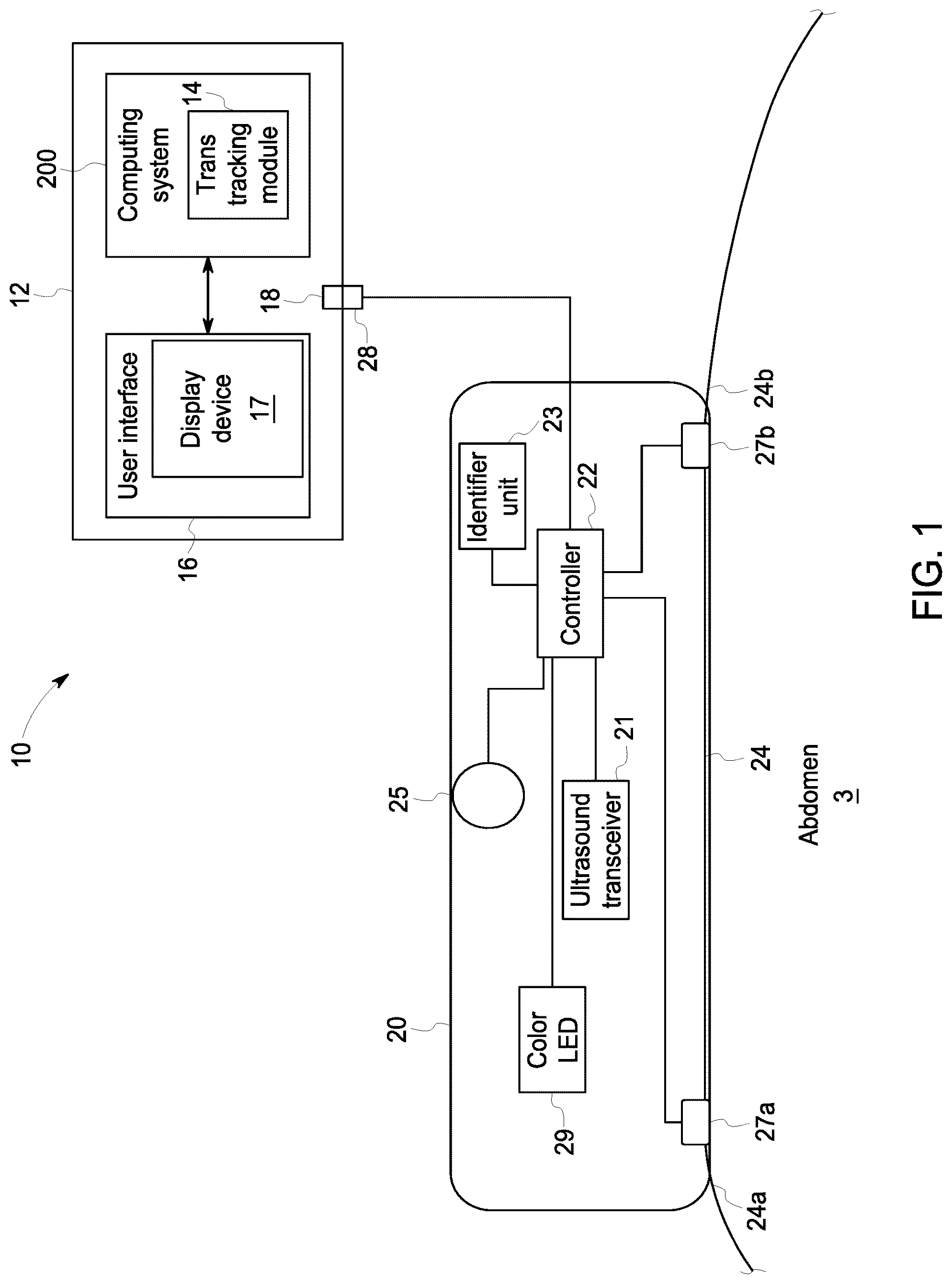 Patent US12102474 — Fetal ultrasound monitoring method and system — Figure 1