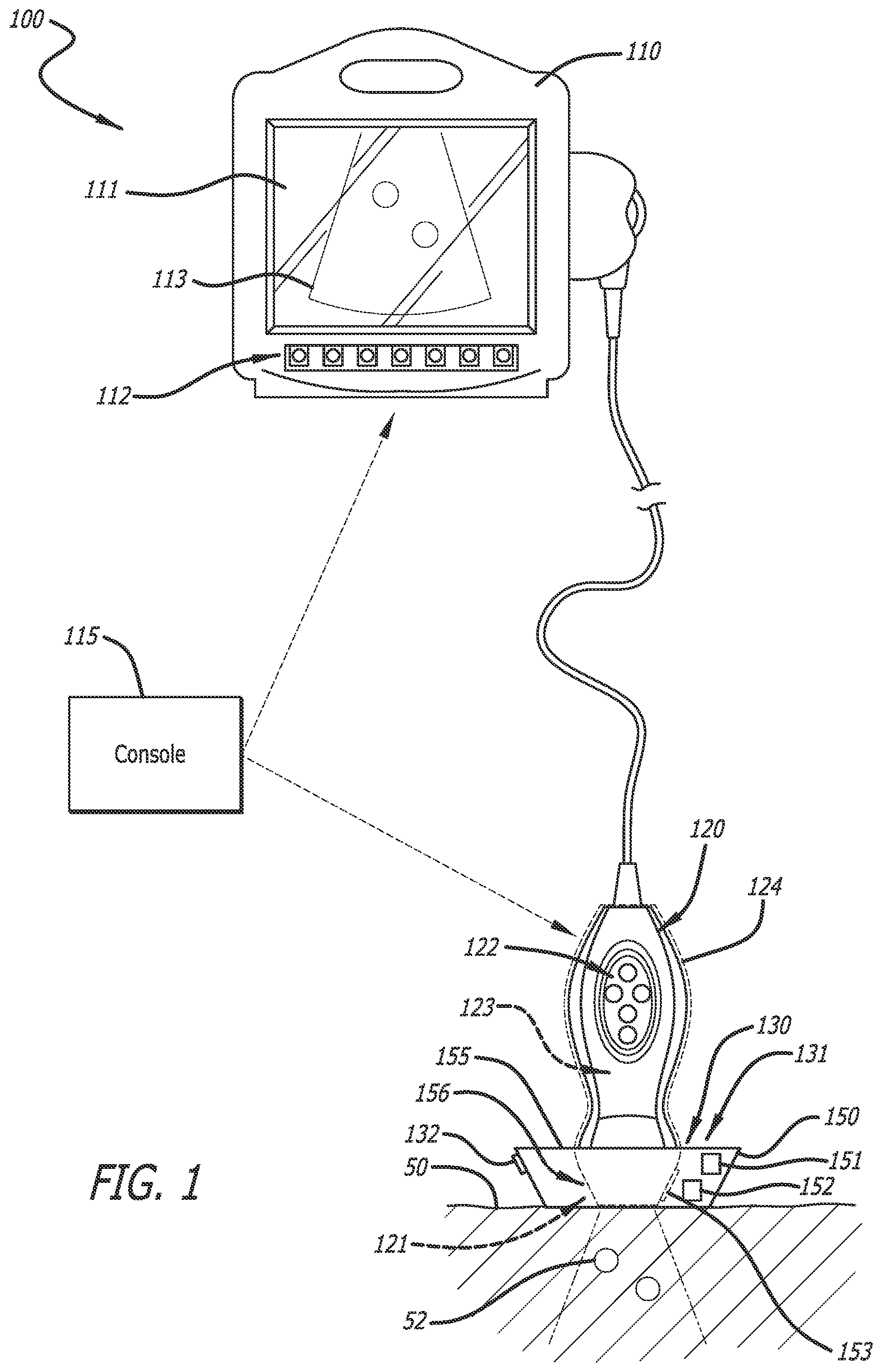 Patent US12102481 — Ultrasound probe with smart accessory — Figure 1