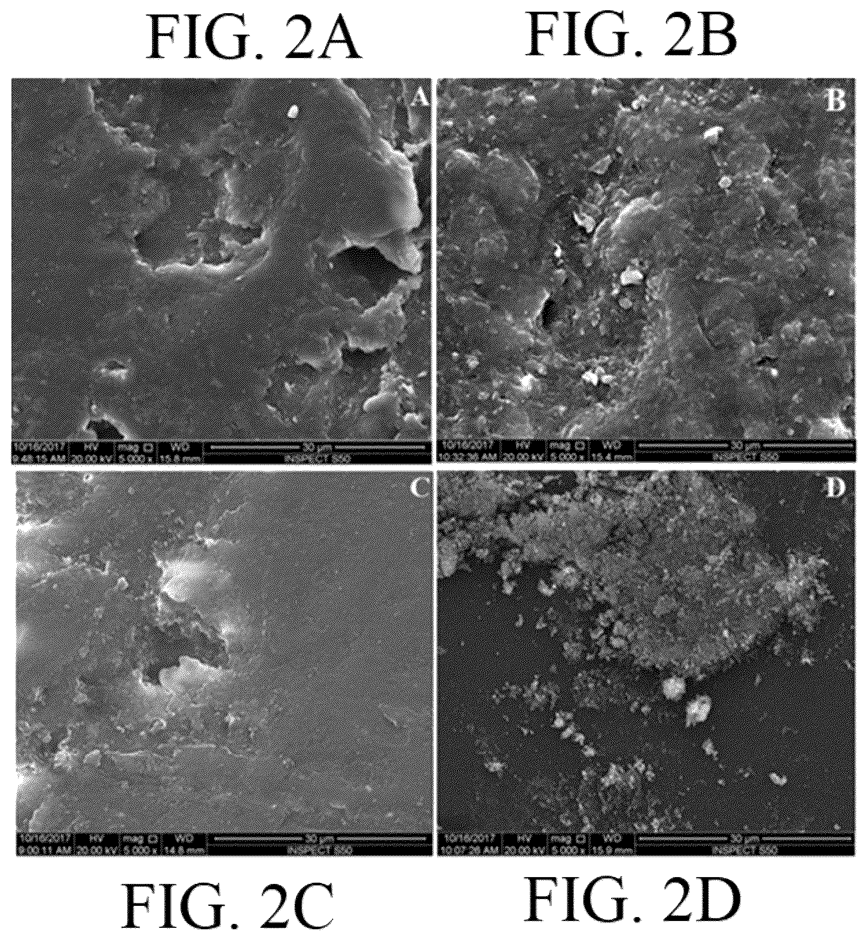 Patent US12102495 Figure 3 – Dental orthodontic retainer with nanodiamond pmma composite material
