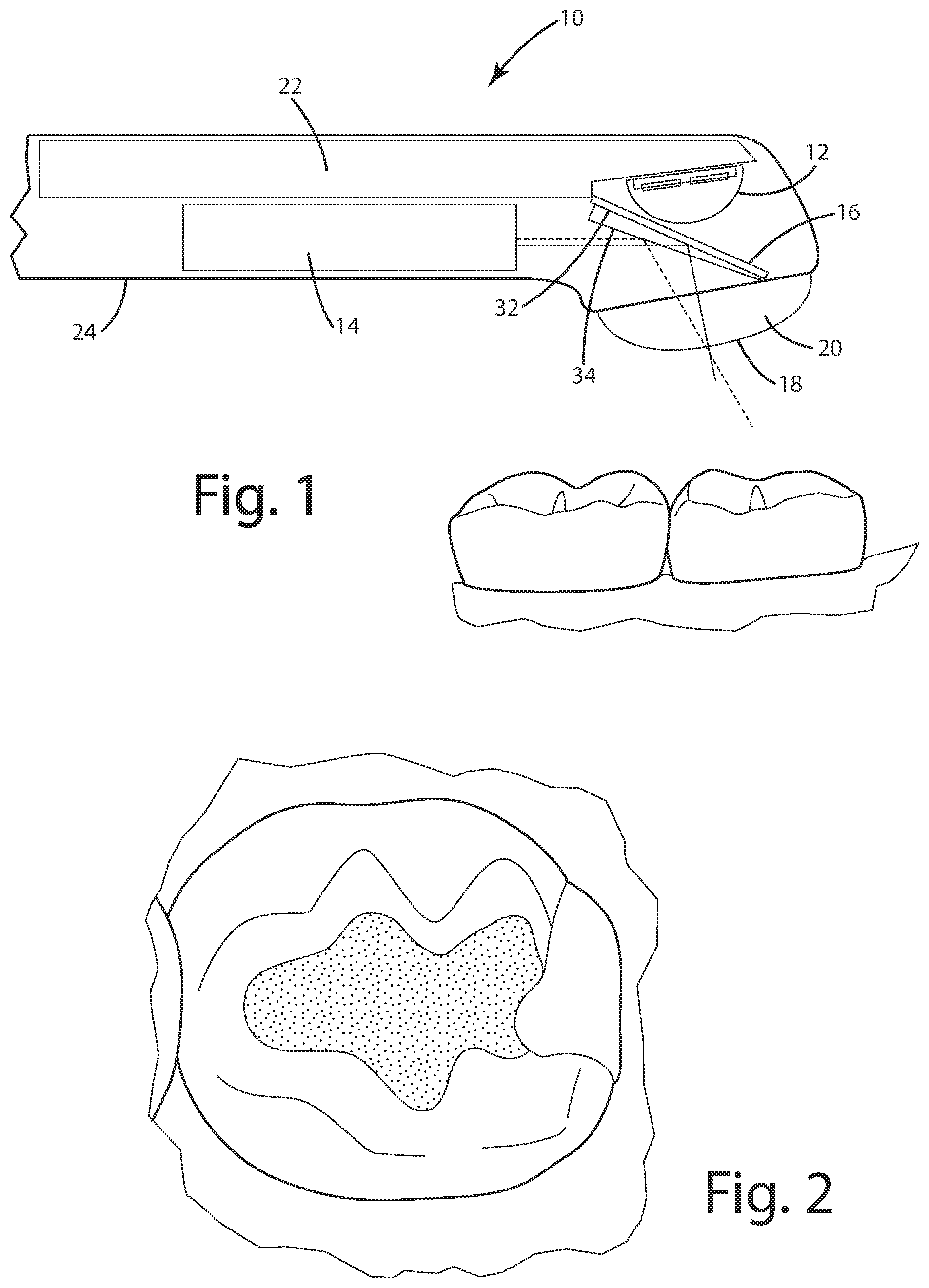 Patent US12102498 — Dental curing light and method — Figure 1