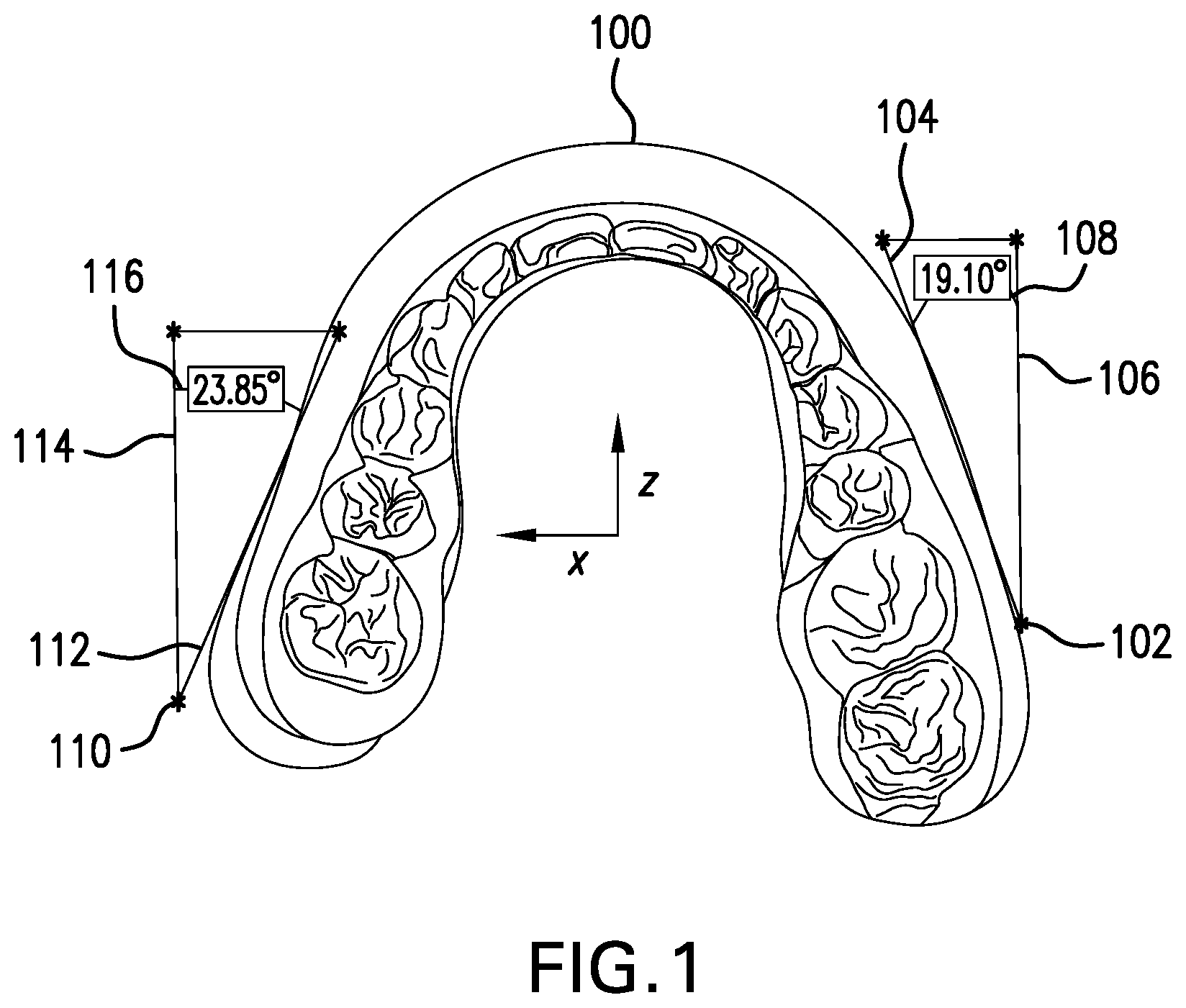 Patent US12102501 — Symmetrical advancement of mandible — Figure 1
