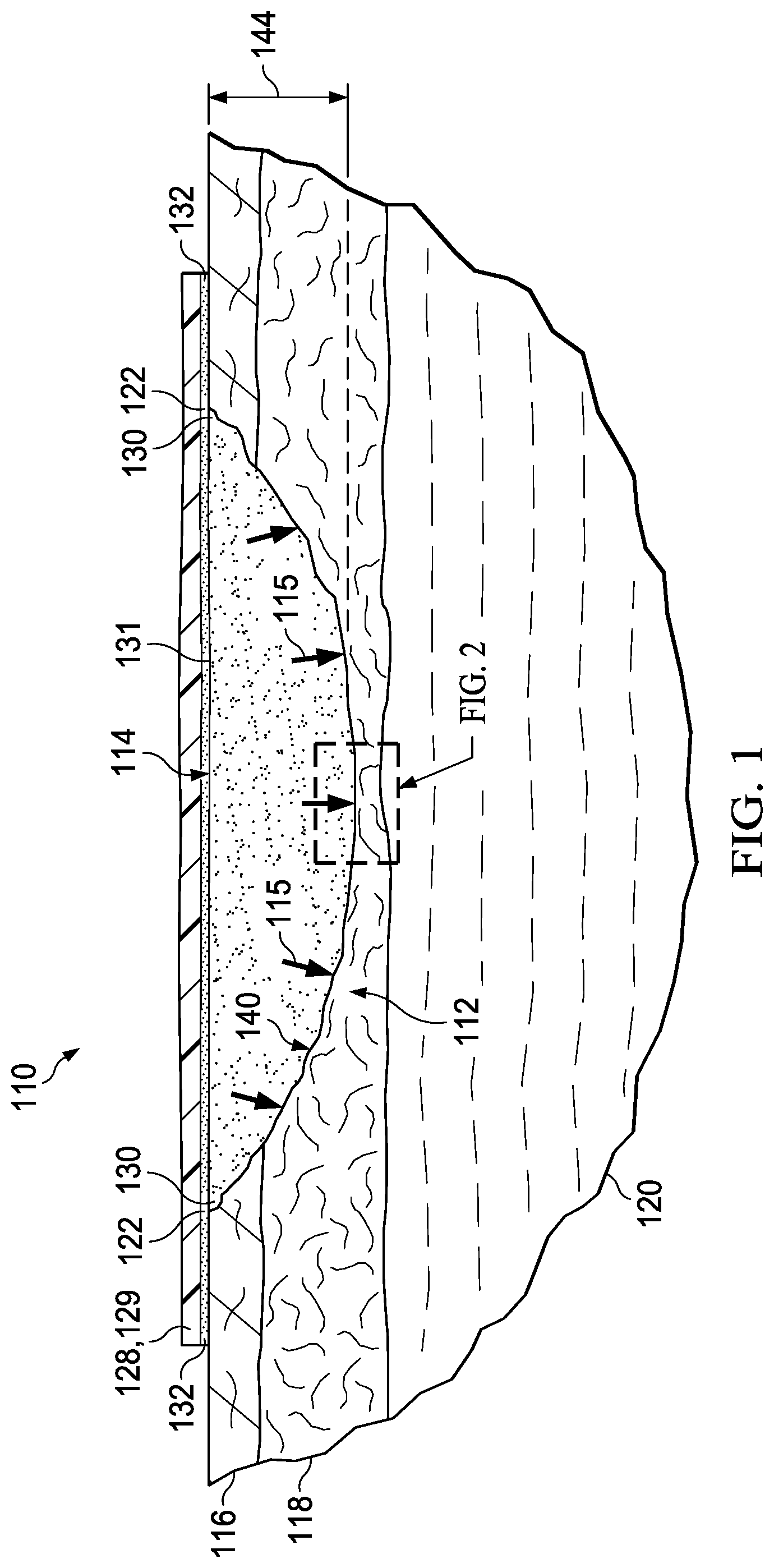 Patent US12102509 — Granulating dressing for low exuding chronic wounds — Figure 1