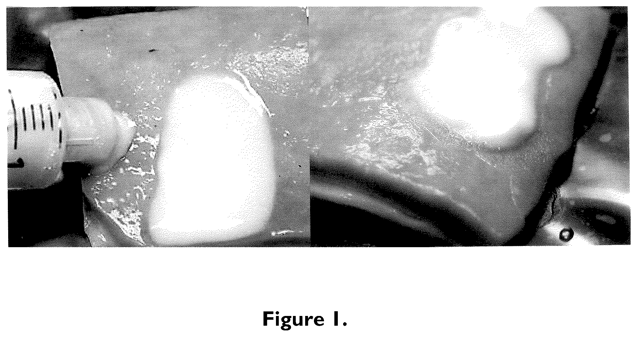 Patent US12102510 — Bimodal treatment methods and compositions for gastrointestinal lesions with active bleeding — Figure 1