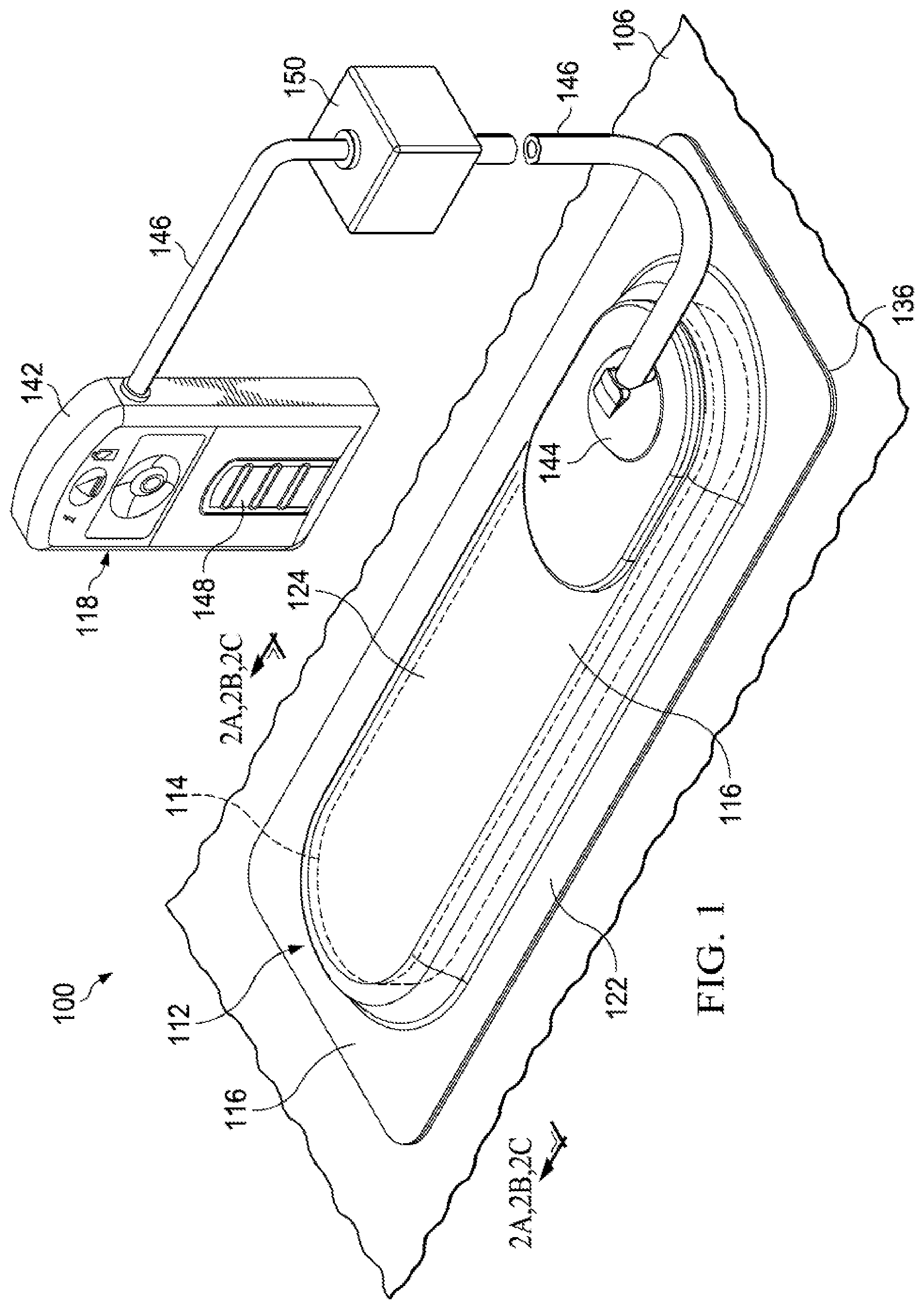 Patent US12102511 — Dressing with variable contraction zones — Figure 1