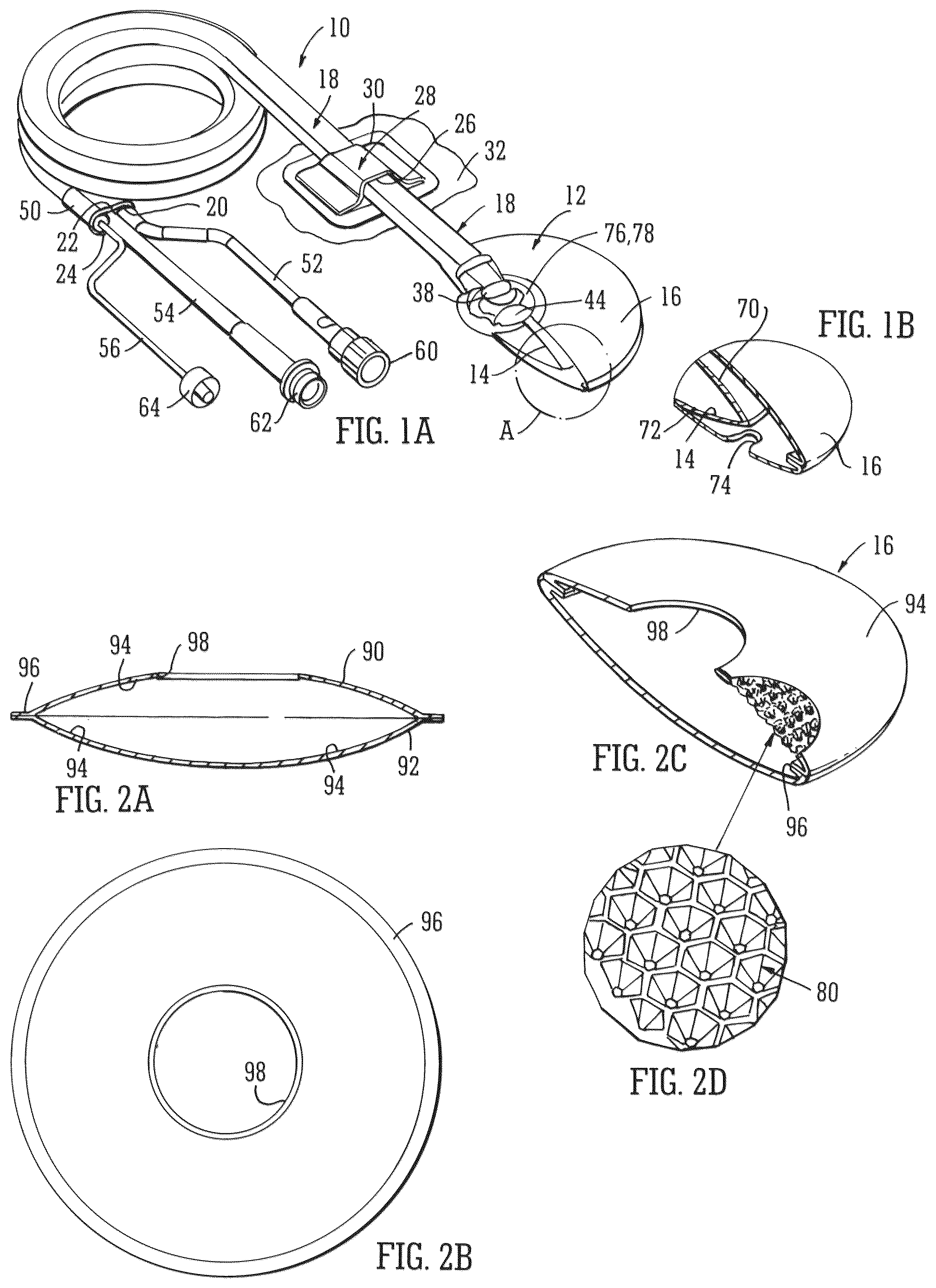 Patent US12102512 — Wound filling apparatuses and methods — Figure 1