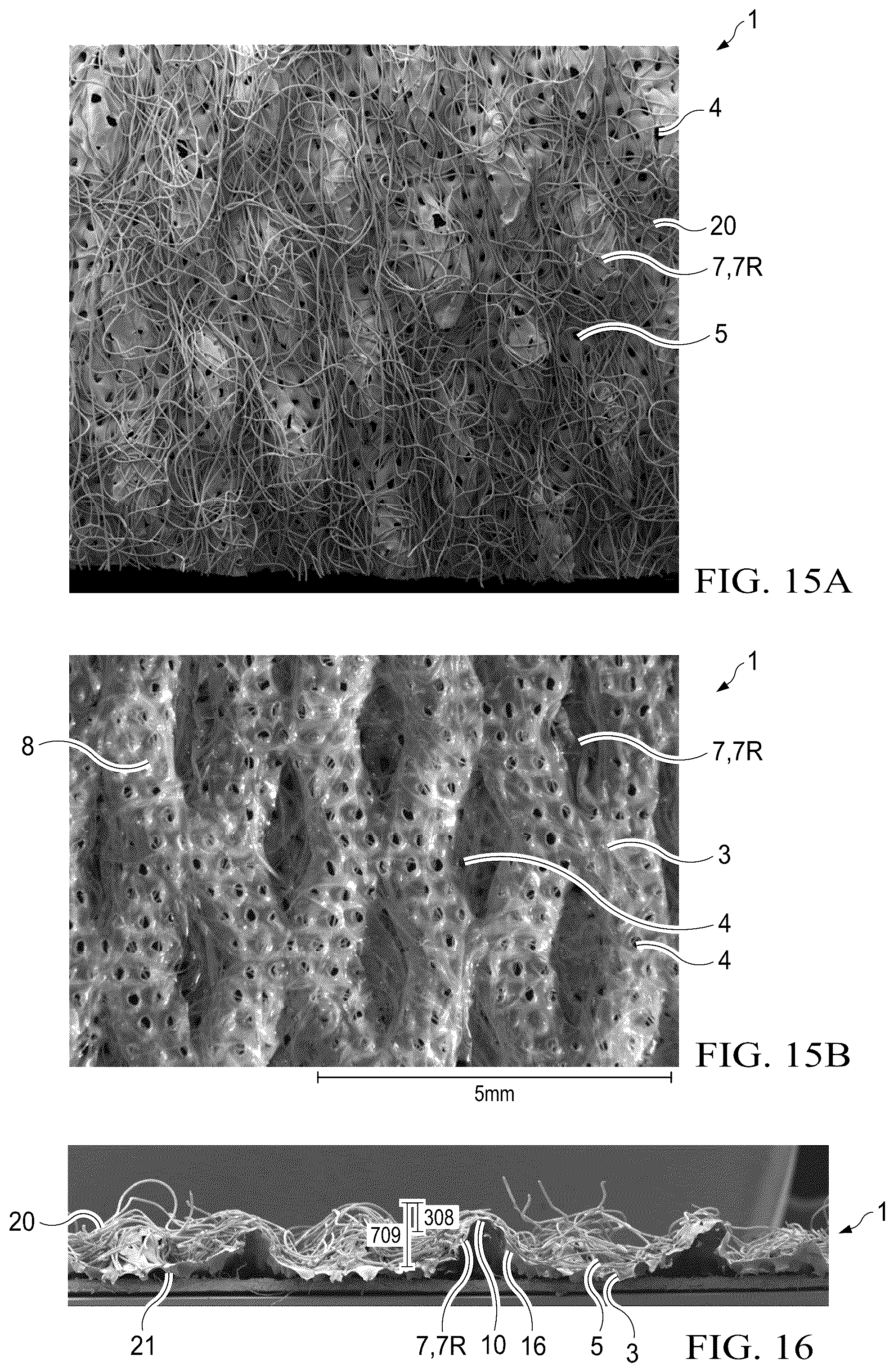 Patent US12102515 Figure 13 – Laminate webs and absorbent articles having the same