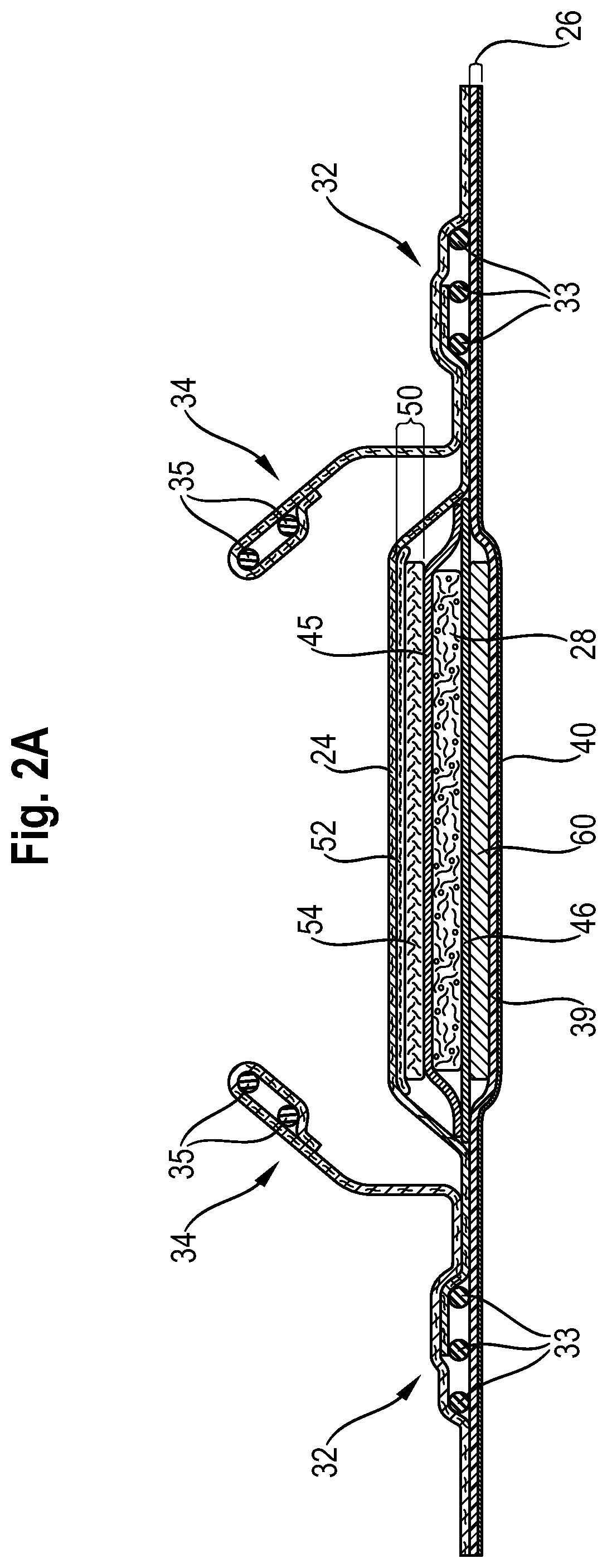 Patent US12102517 Figure 2 – Absorbent article comprising a lower acquisition and distribution system