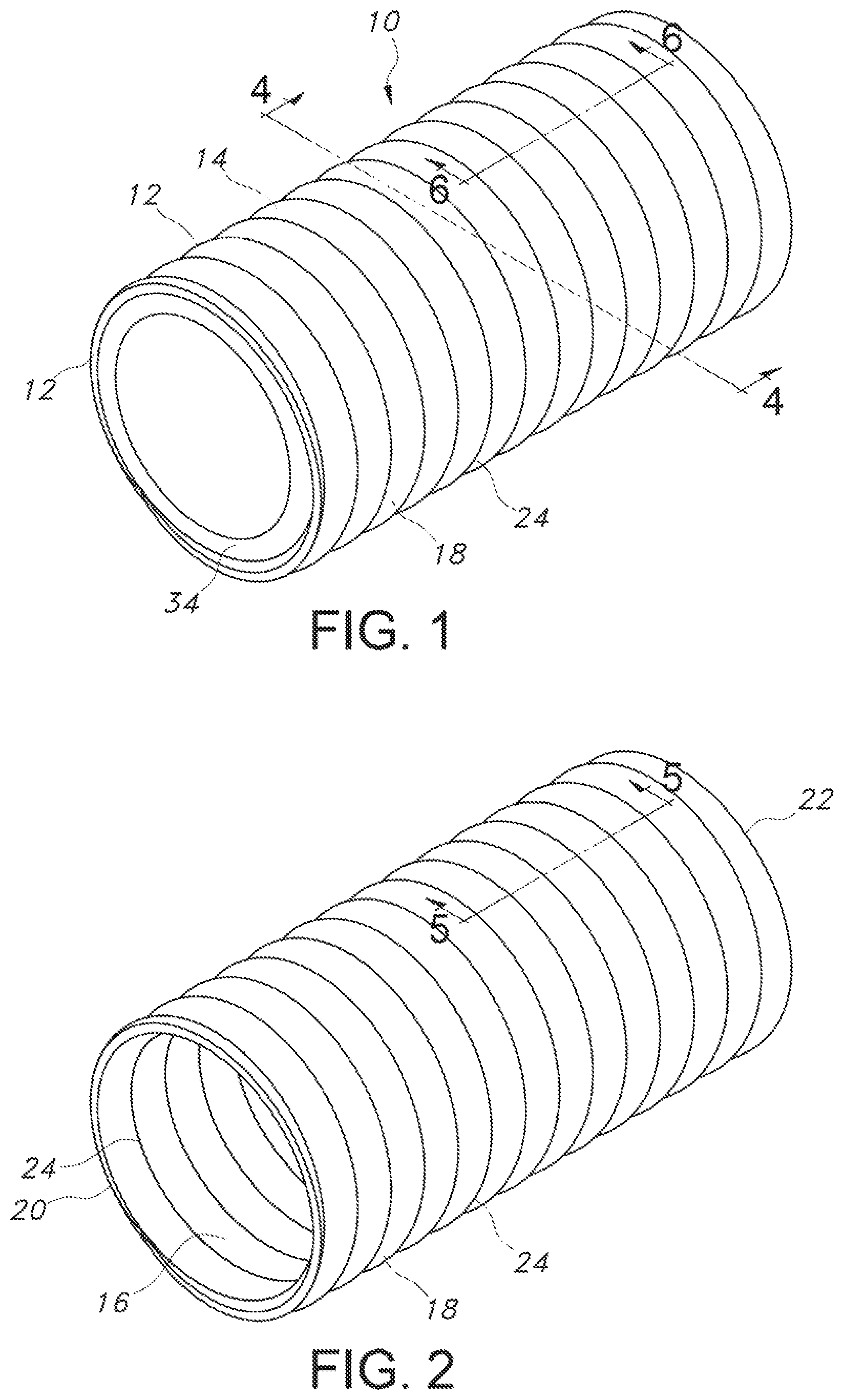 Patent US12102521 — Crimped textile graft with polymer liner — Figure 1