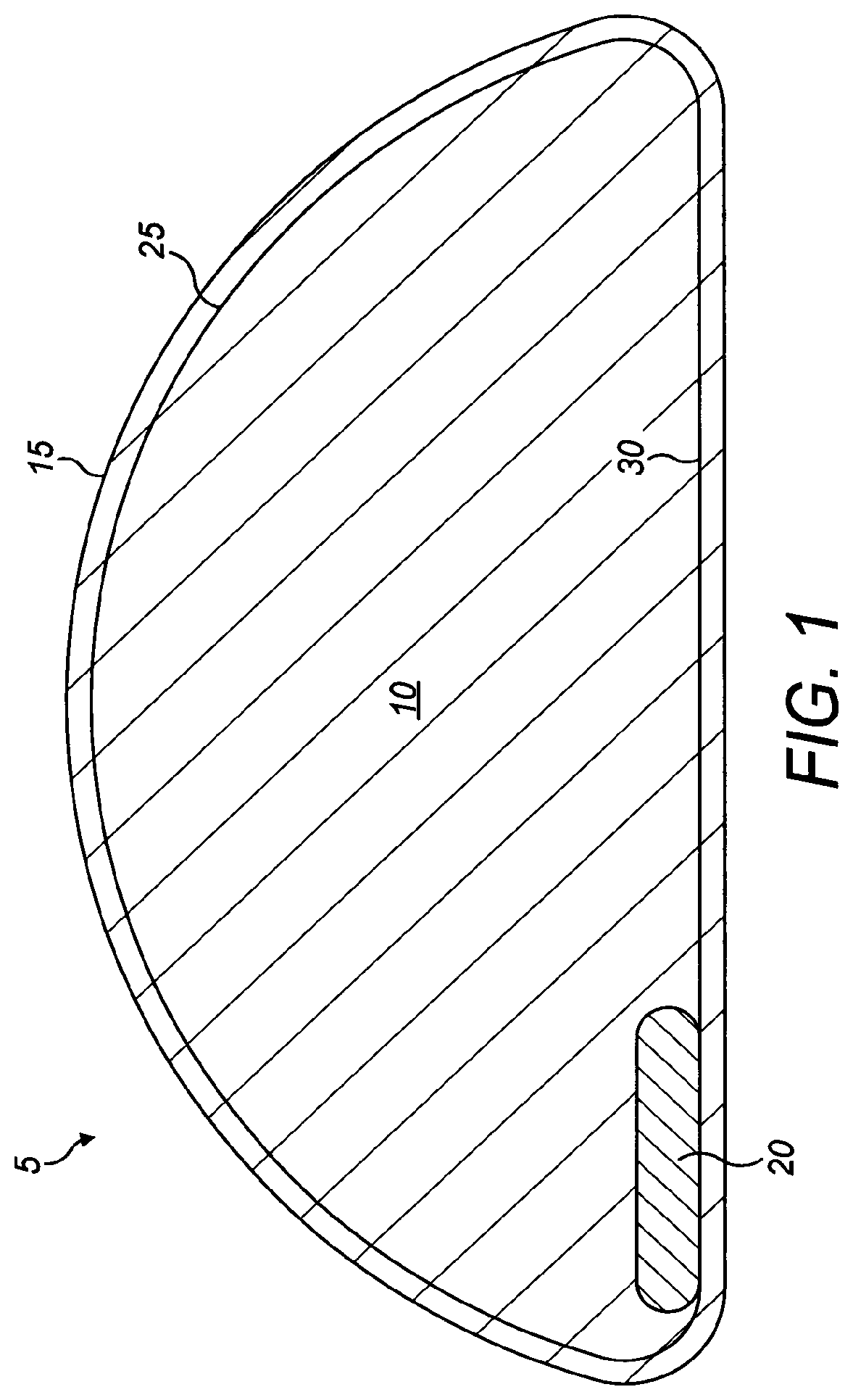Patent US12102523 — Implant — Figure 1